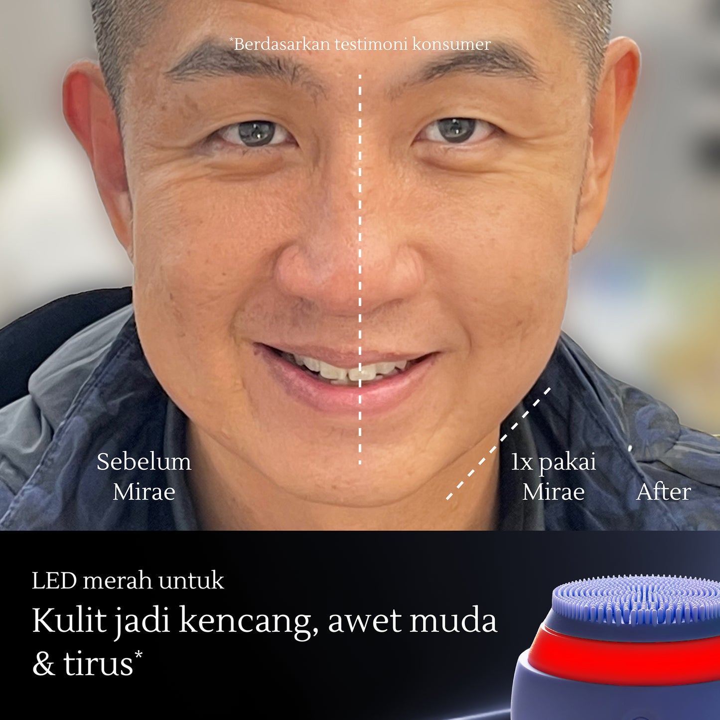 Facial Sonic Cleansing Device | Pembersih Wajah | Pembersih Wajah Elektrik | Jerawat | Kulit Kusam | Kulit Kendur | Komedo | Bekas Jerawat | Bruntusan | Deep Cleansing | Pembersih Wajah Silikon Tahan Air | Alat Pembersih Wajah
