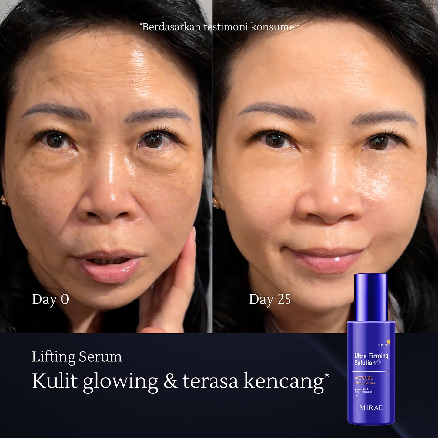 Retinol Lifting Serum 30ml | Anti Wrinkle | Atasi Kerutan | Mencerahkan Wajah | Mengencangkan Wajah | Ultra Firming Solution | Retinol Serum