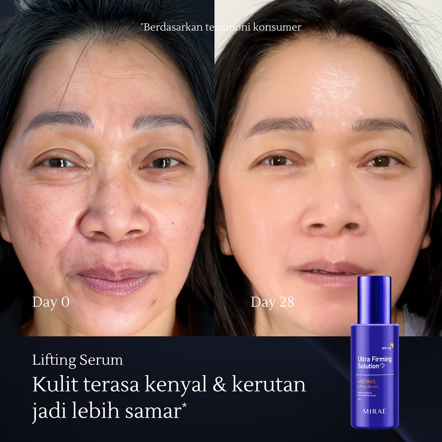 Retinol Lifting Serum 30ml | Anti Wrinkle | Atasi Kerutan | Mencerahkan Wajah | Mengencangkan Wajah | Ultra Firming Solution | Retinol Serum