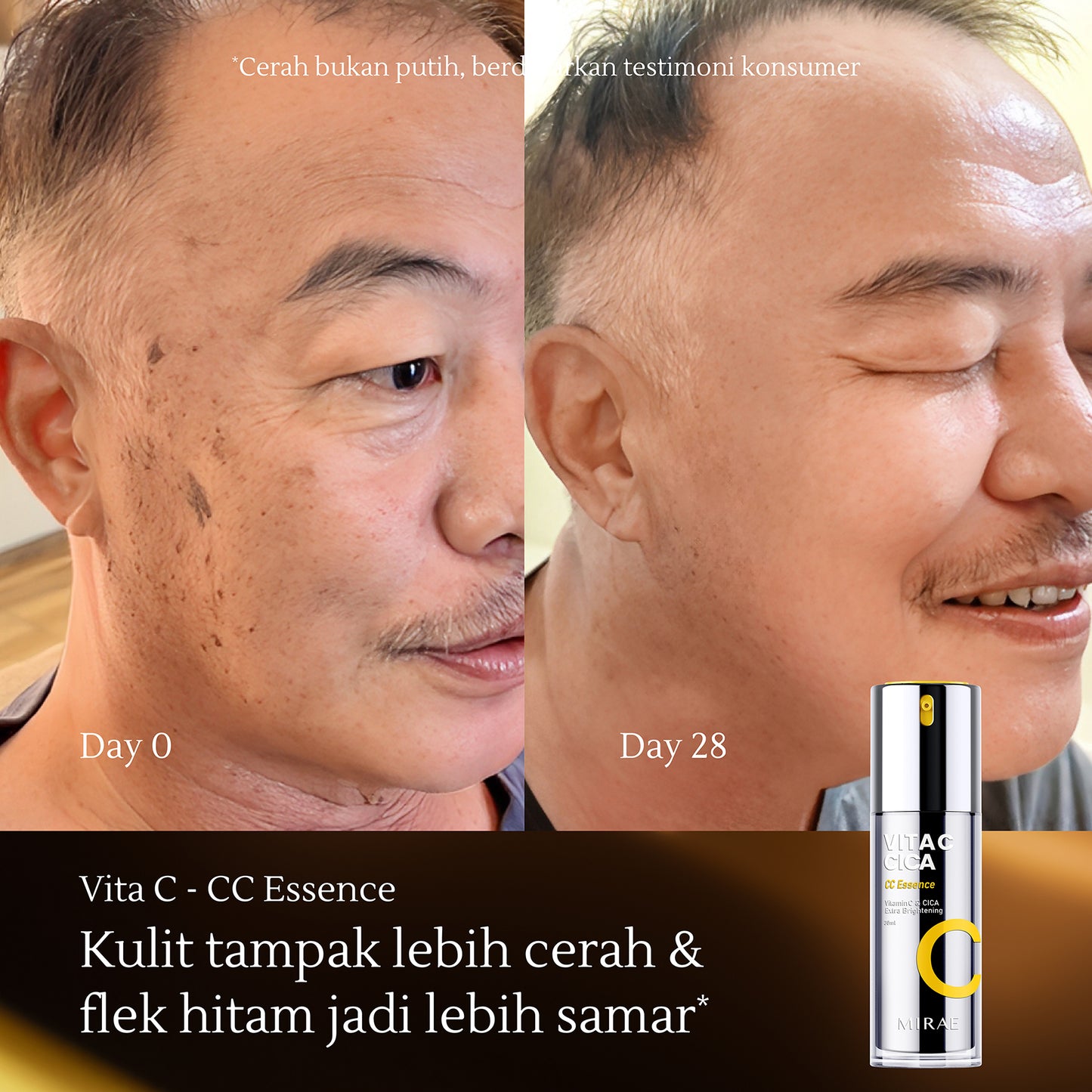 Vitamin C CICA Extra Brightening Essence 30ml | Kulit Kusam | Jerawat | Noda Hitam | Bekas Jerawat | Flek Hitam | Bruntusan | Kulit Kemerahan | Mencerahkan Kulit | Glowing