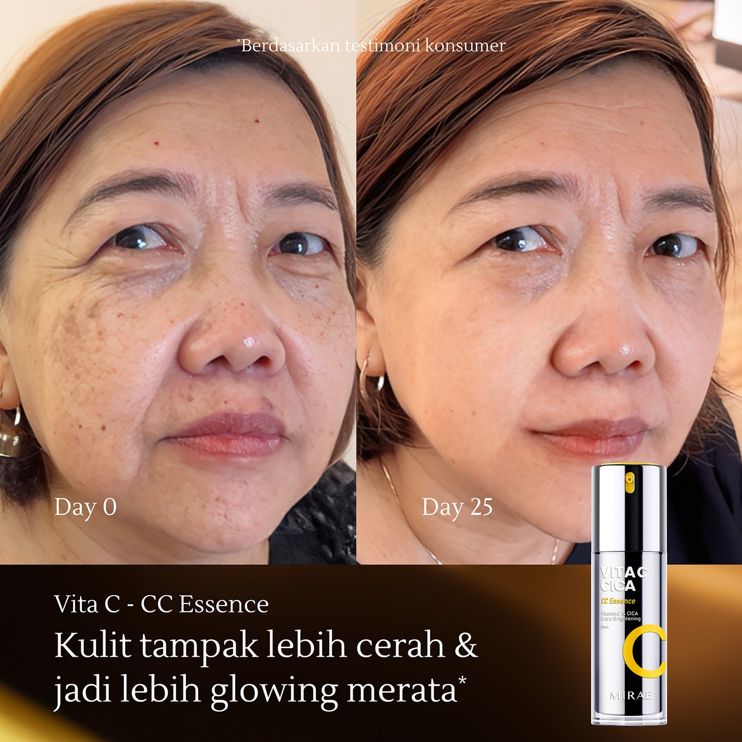 Vitamin C CICA Extra Brightening Essence 30ml | Kulit Kusam | Jerawat | Noda Hitam | Bekas Jerawat | Flek Hitam | Bruntusan | Kulit Kemerahan | Mencerahkan Kulit | Glowing