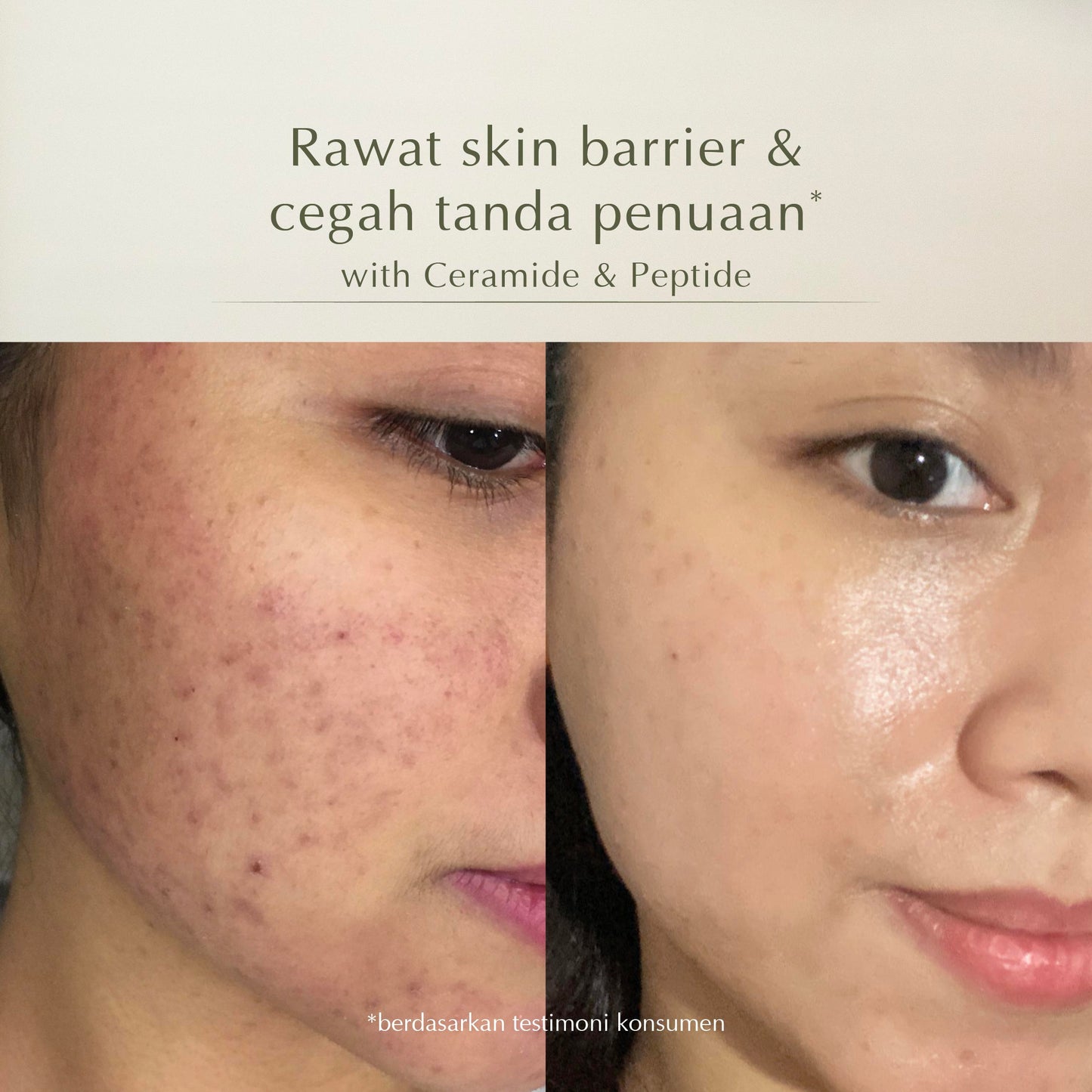 5x Hyaluronic Moisture Lock Gel | Pelembap Muka | Meredakan Kulit Kering | Hyaluronic Acid | Mengurangi kemerahan | Menghilangkan Jerawat (Copy)
