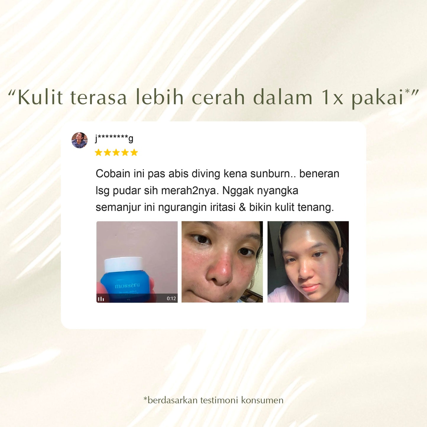 5x Hyaluronic Moisture Lock Gel | Pelembap Muka | Meredakan Kulit Kering | Hyaluronic Acid | Mengurangi kemerahan | Menghilangkan Jerawat (Copy)