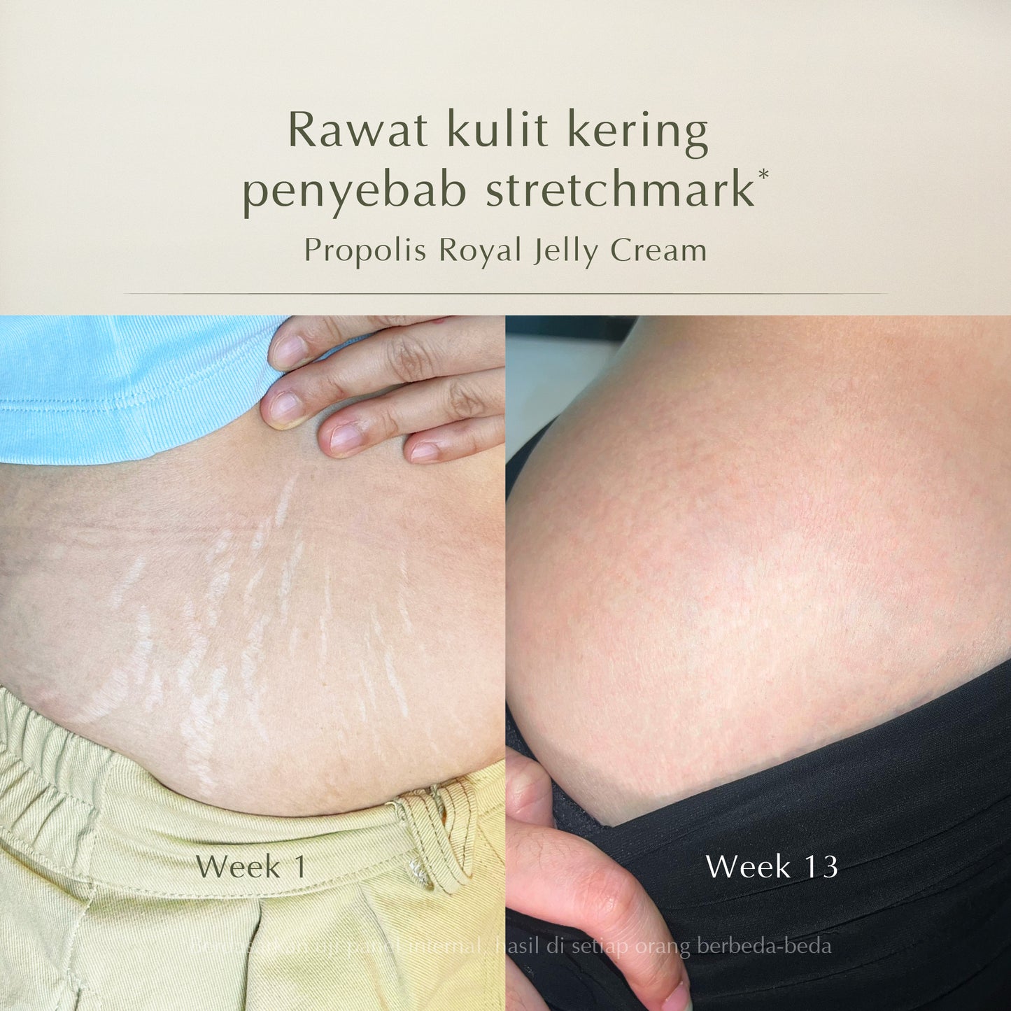Royal Jelly Body Cream - Body Butter 170gr | Pelembap Badan | Anti Aging | Body Serum | Body Lotion | Brightening Lotion | Hand Body | Body Care