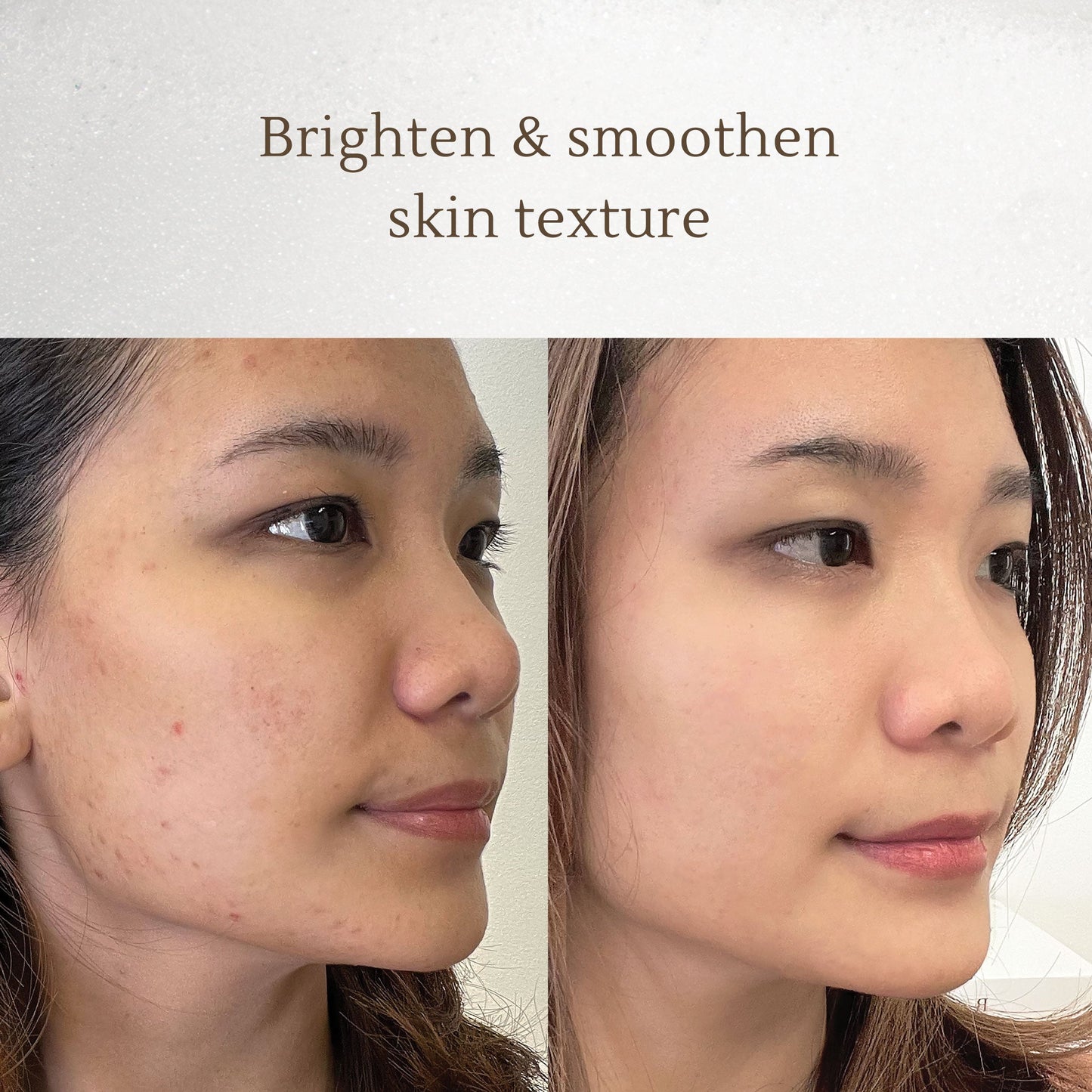 Face wash 3 in 1 Brightening Cleansing Foam - 150ml | Pembersih Wajah | Facial Wash | Face Massage | Kulit sensitif | Hydrating | Mencerahkan | Bekas jerawat | Hiperpigmentasi | Flek hitam | Noda hitam | Niacinamide | Glutathione | Vitamin C
