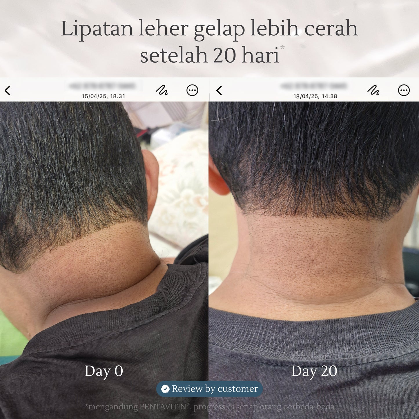 Afternoon Teahouse Bodywash | Sabun Mandi/Lipatan Gelap/Kulit Kering/Gatal/Luka Basah (300ml)