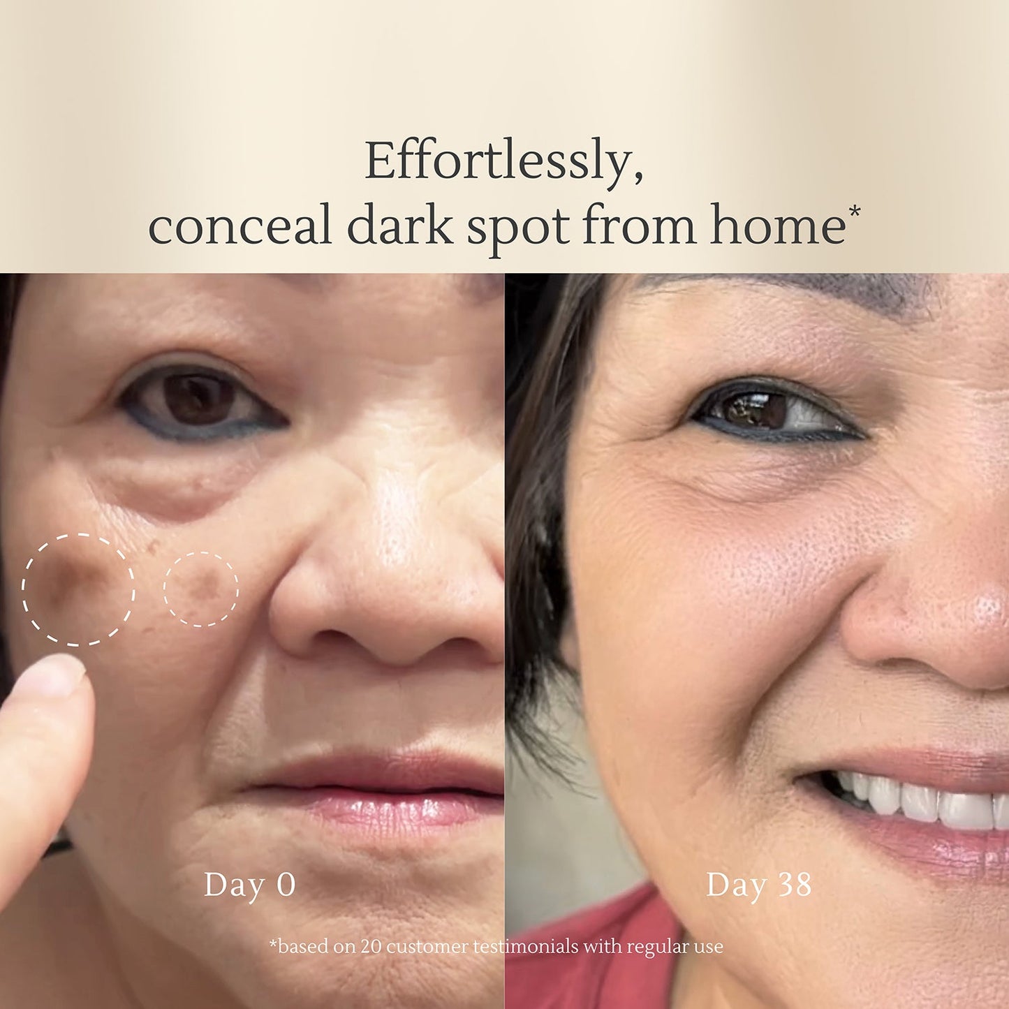 Dark Spot Correcting Serum 15gr | Noda gelap | Flek hitam | Bekas Jerawat PIH | Warna Kulit Tidak Merata | Alcohol Free | Fragrance Free