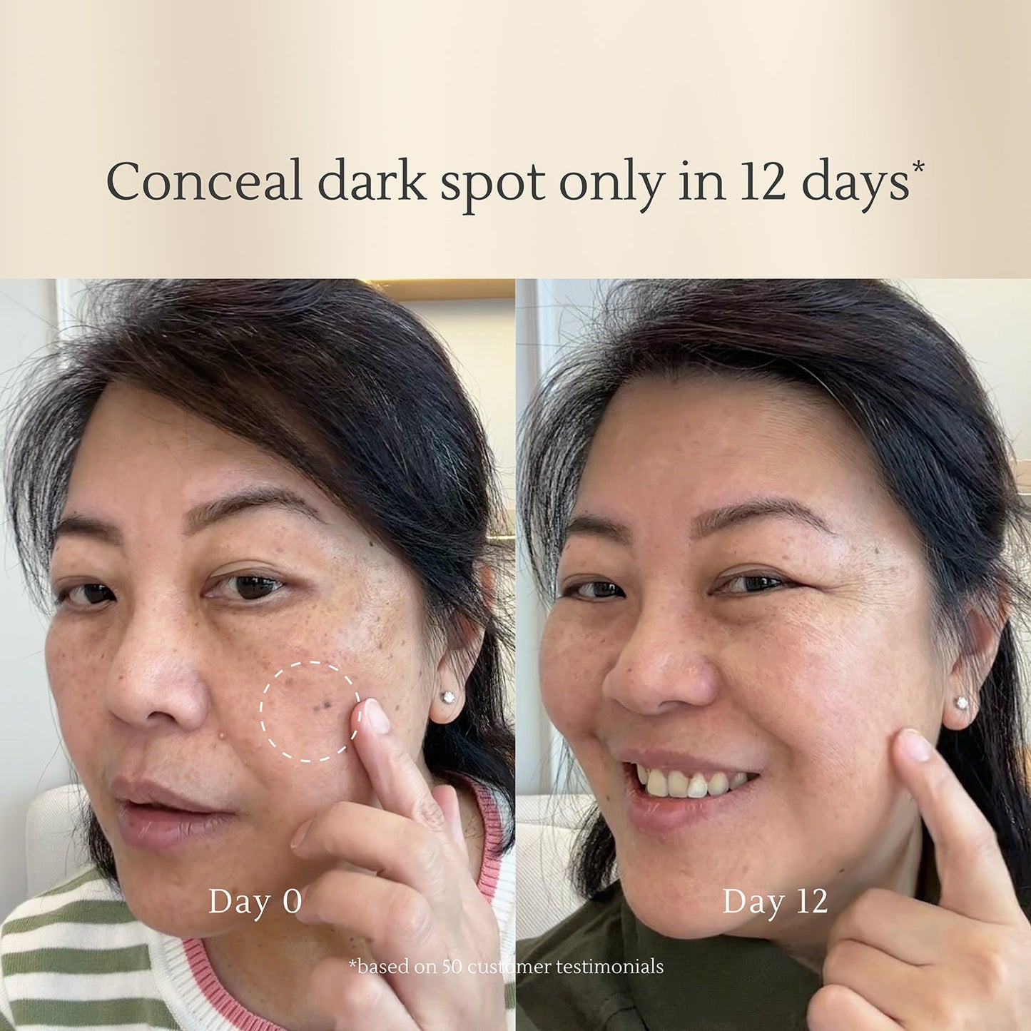Dark Spot Correcting Serum 15gr | Noda gelap | Flek hitam | Bekas Jerawat PIH | Warna Kulit Tidak Merata | Alcohol Free | Fragrance Free