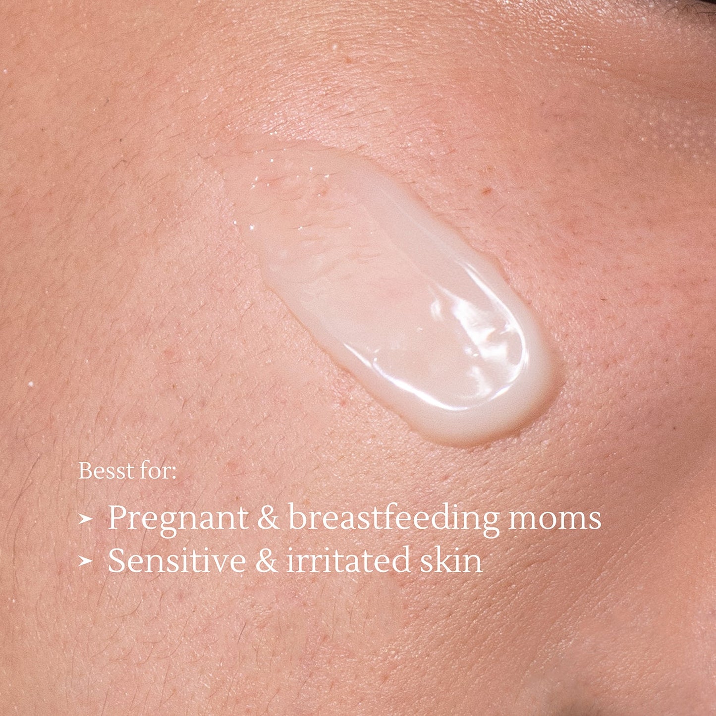 Dark Spot Correcting Serum 15gr | Noda gelap | Flek hitam | Bekas Jerawat PIH | Warna Kulit Tidak Merata | Alcohol Free | Fragrance Free