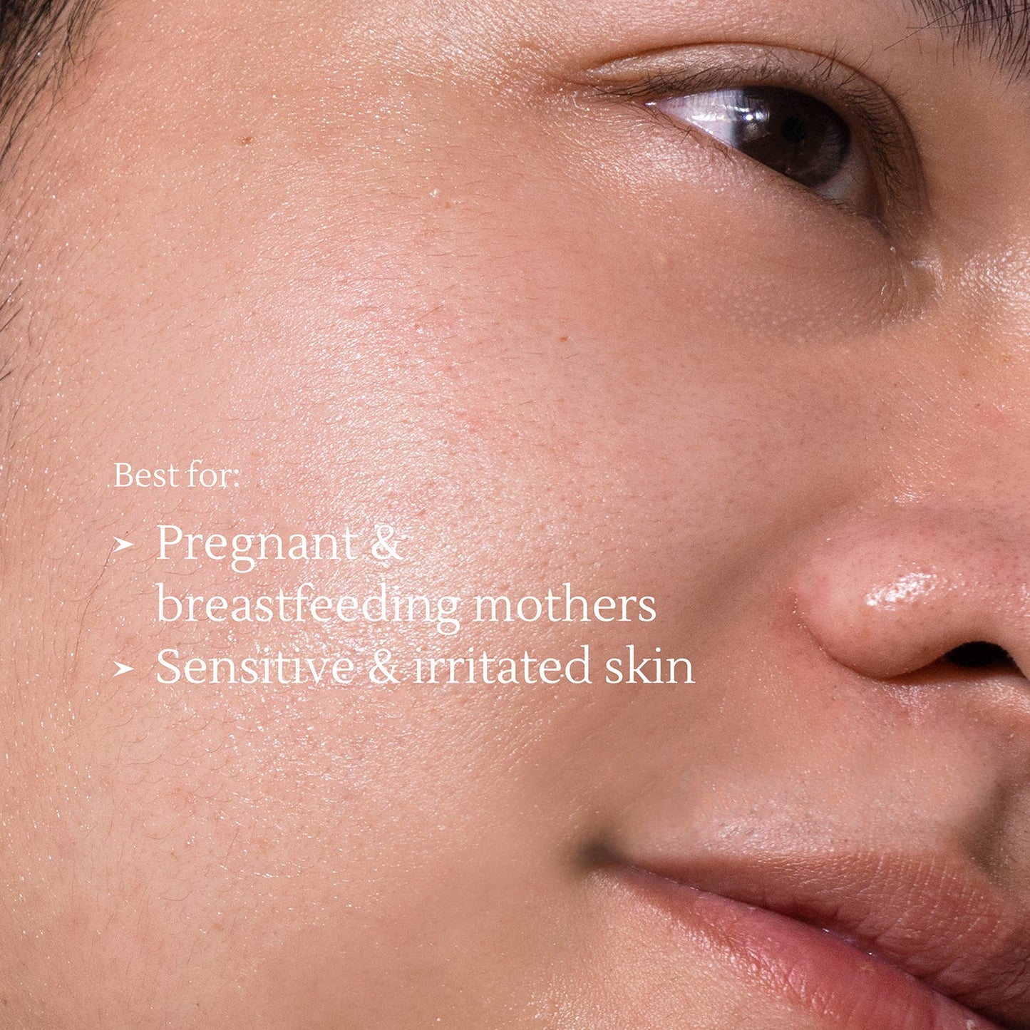 Acne Cleansing Cream 100g | Jerawat | Oily Skin | Kulit Sensitif | Alcohol Free | Fragrance Free | Facial Wash