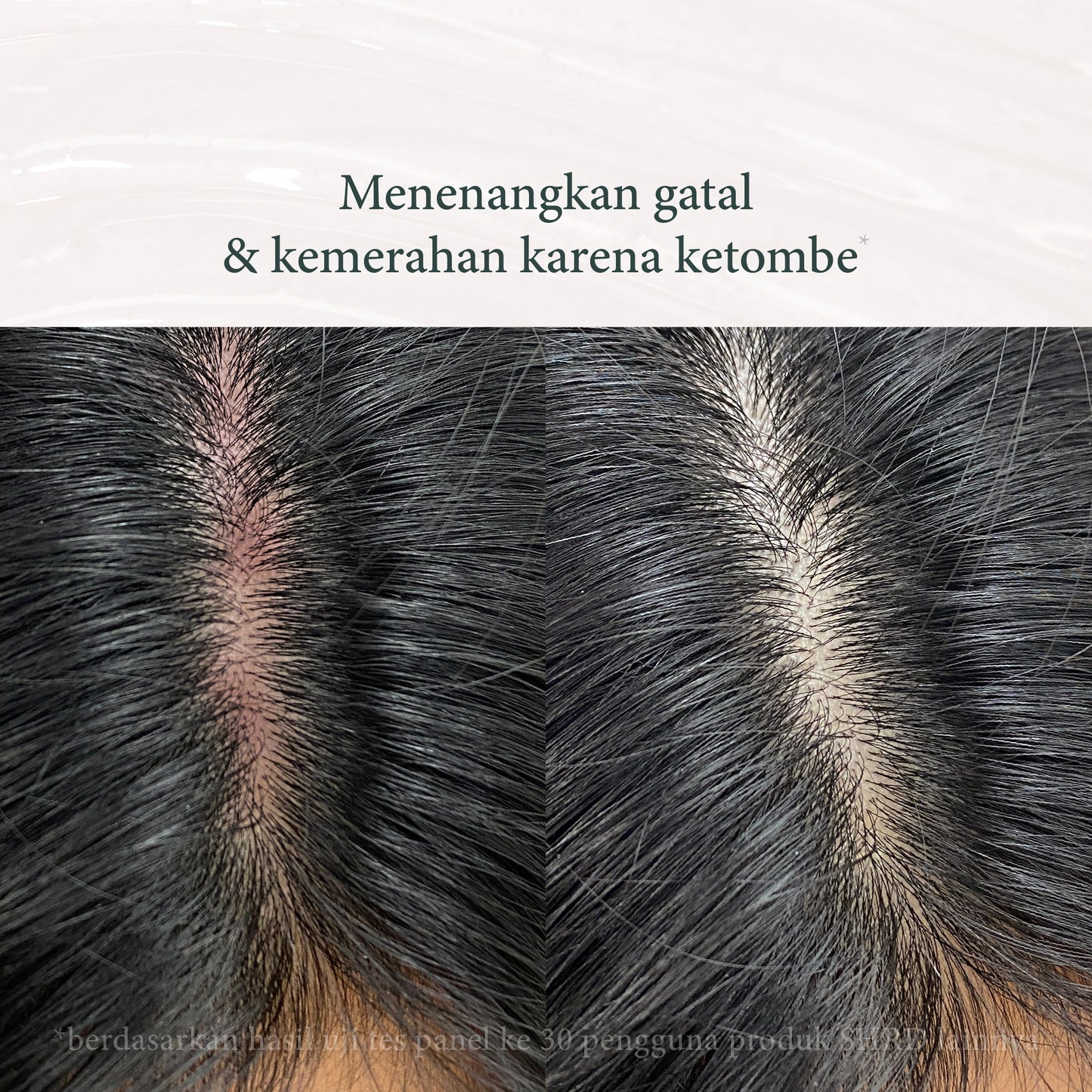 Keratin Shampoo - 250 ml | Perawatan Rambut | Lepek | Oil Control | Oily | Keratin | Haircare