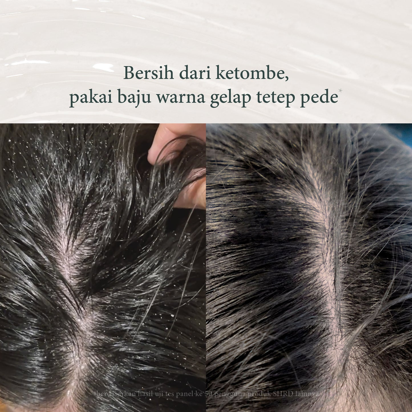 Tea Tree | shampoo anti ketombe | Perawatan Rambut | Gatal | Ketombe | Ketombe kering | Kering | Sensitive Scalp | Haircare