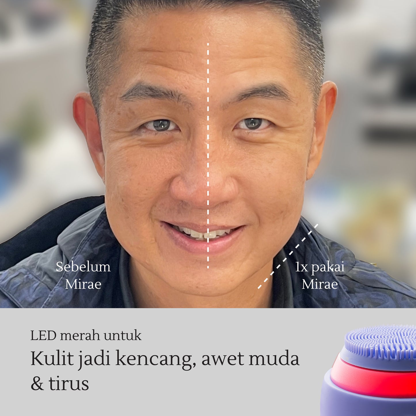 Anti-Aging Set: Facial Sonic Cleansing Device + Retinol Facial Cleanser