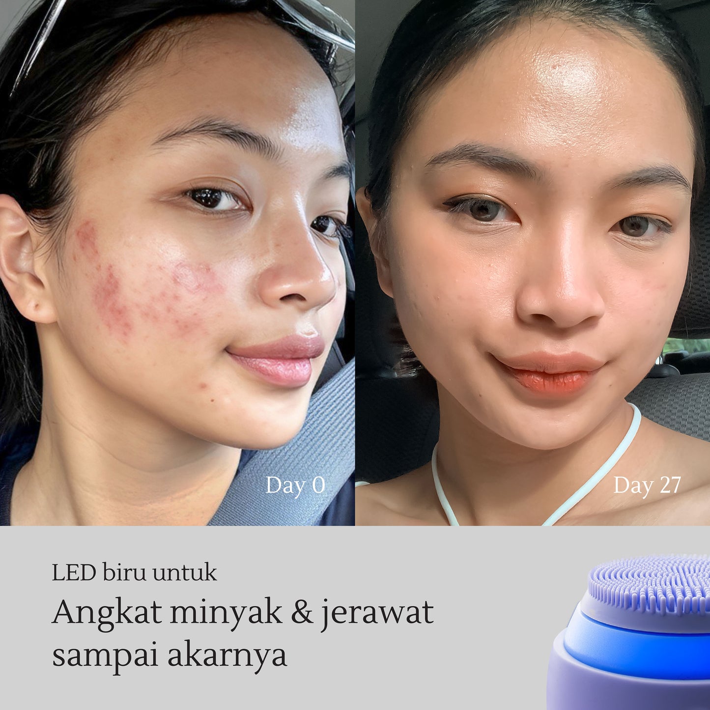 Anti-Aging Set: Facial Sonic Cleansing Device + Retinol Facial Cleanser