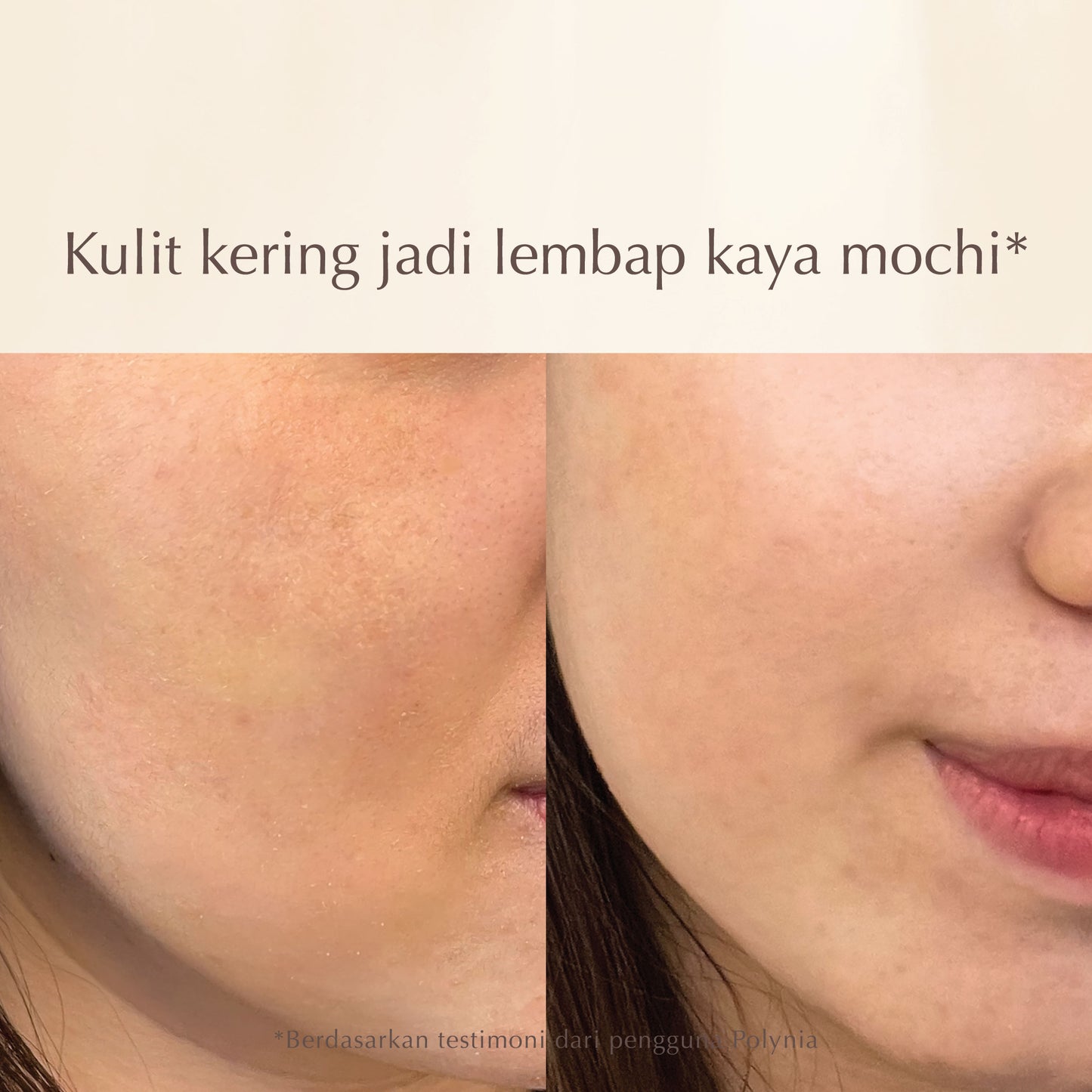Prickly Pear Hydrating Face Mask | Nutrisi kulit & Memperkuat Skin Barrier | Jaga kelembapan kulit | BPOM