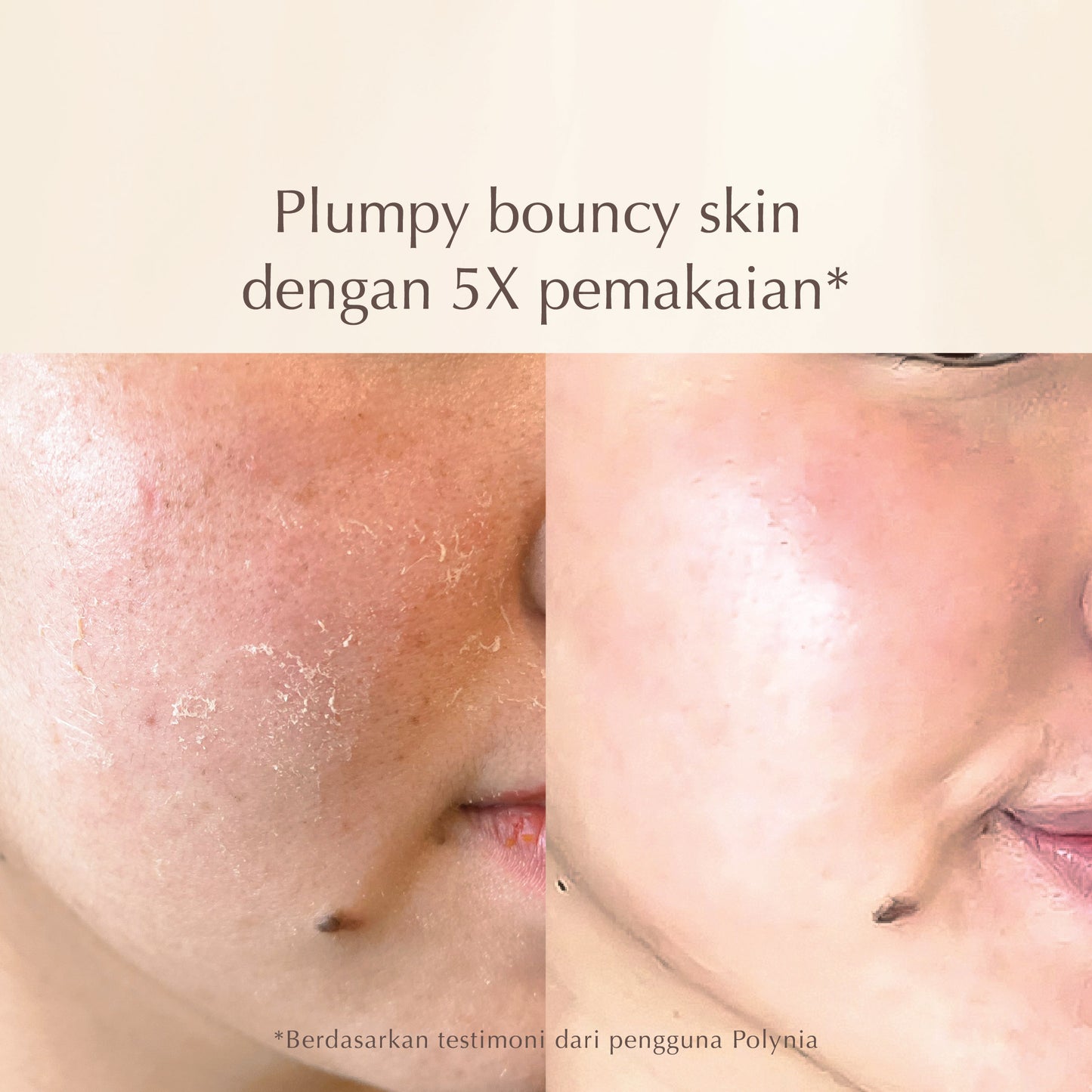 Prickly Pear Hydrating Face Mask | Nutrisi kulit & Memperkuat Skin Barrier | Jaga kelembapan kulit | BPOM