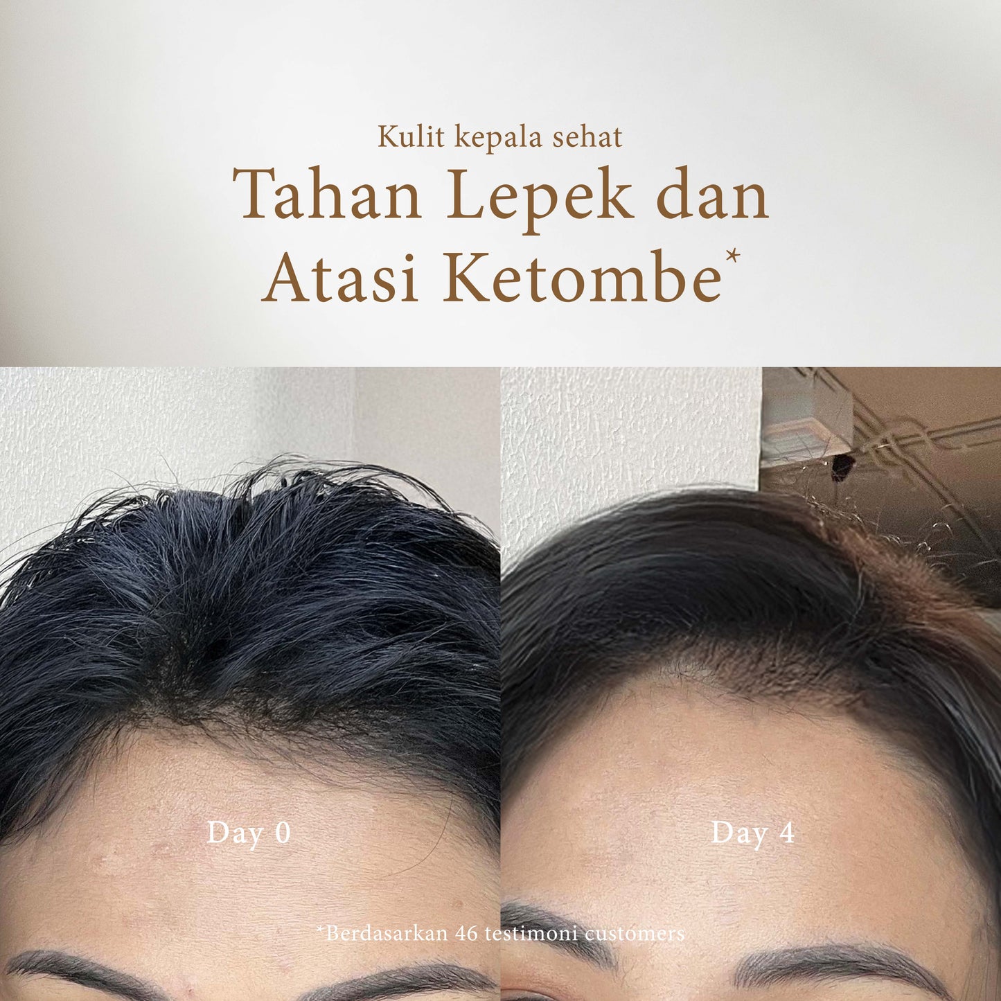 Peony & Amber Shampoo | Anti Ketombe | Rontok | Lepek | Berminyak | French Perfume Shampoo | BPOM | Gentle Shampoo