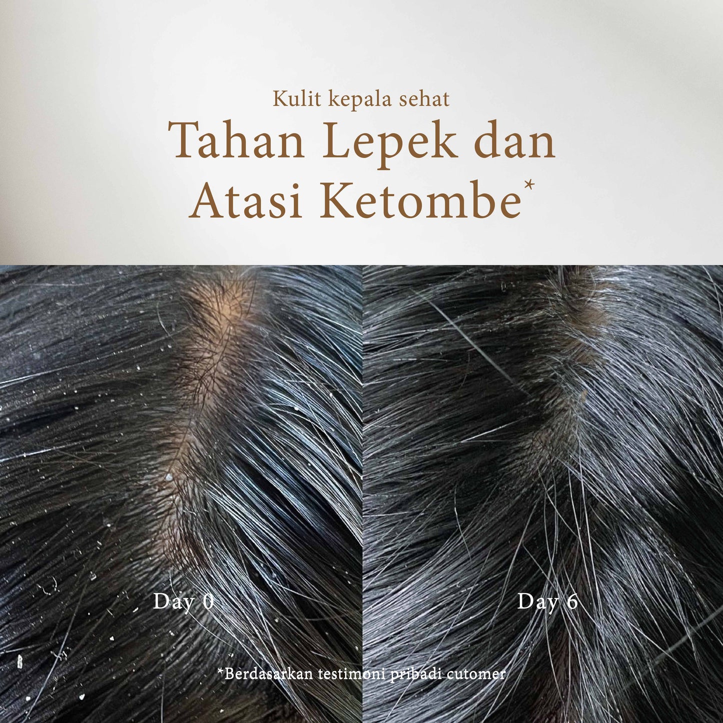 Peony & Amber Shampoo | Anti Ketombe | Rontok | Lepek | Berminyak | French Perfume Shampoo | BPOM | Gentle Shampoo