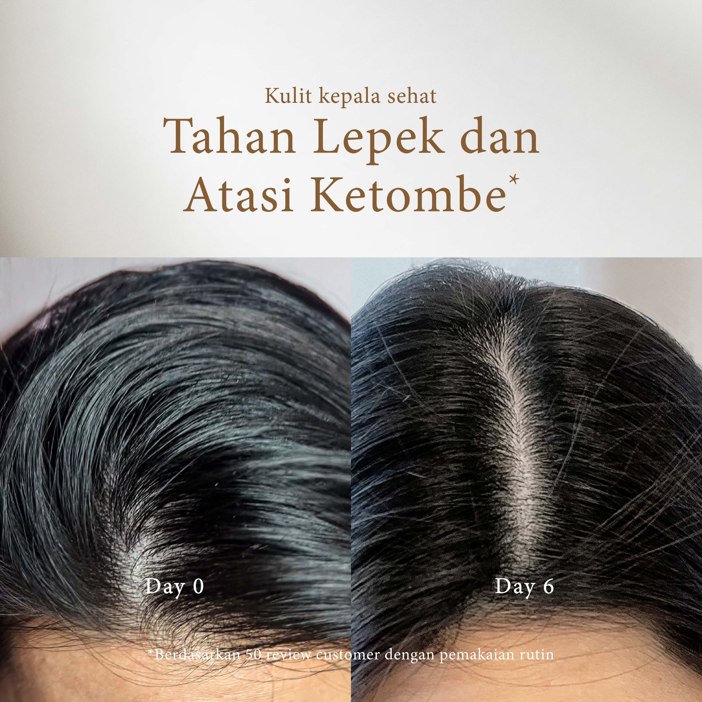Rose & Oud Shampoo | Anti Ketombe | Rontok | Lepek | Berminyak  | French Perfume Shampoo | 500ml