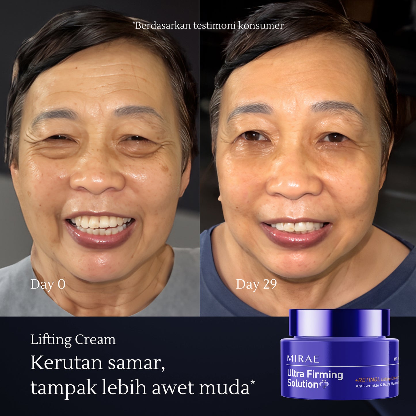 Retinol Lifting Cream 50ml | Kulit Kusam | Anti Aging | Kulit Kendur | Melembabkan Wajah | Ultra Firming Solution | Retinol Cream