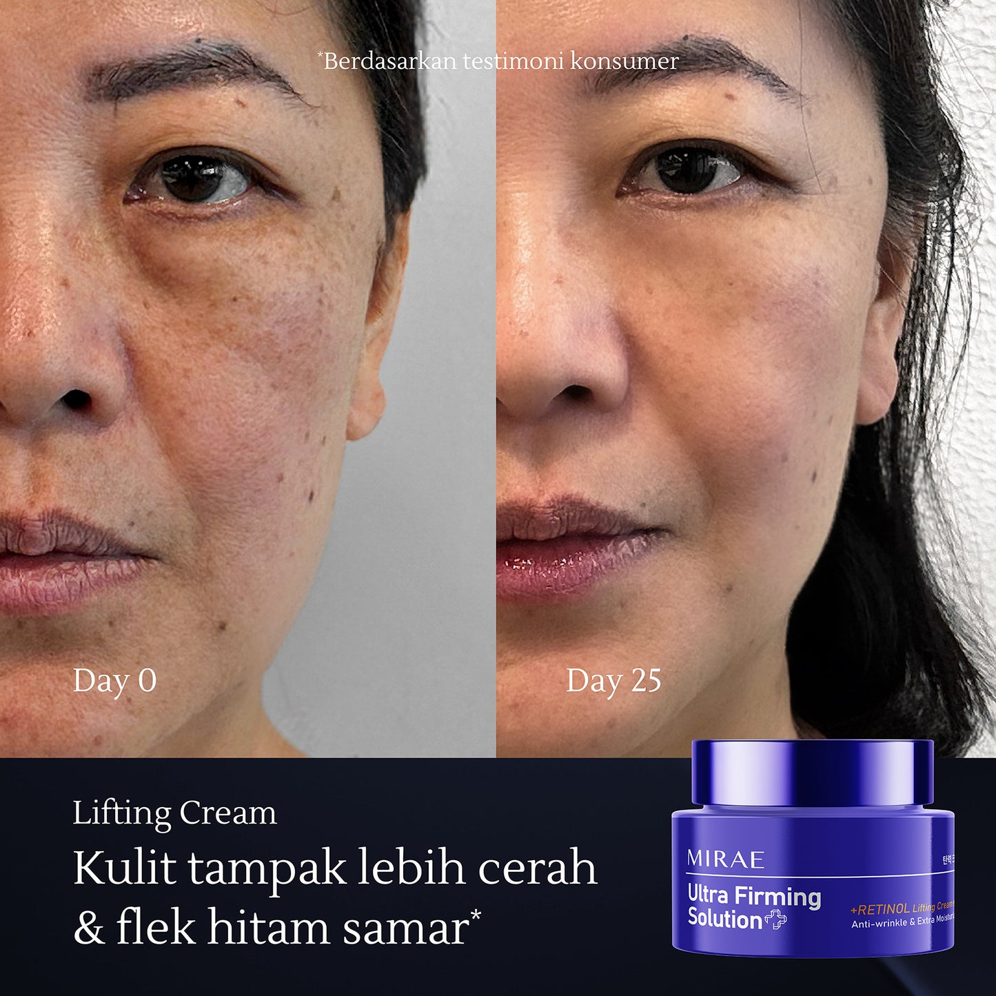 Retinol Lifting Cream 50ml | Kulit Kusam | Anti Aging | Kulit Kendur | Melembabkan Wajah | Ultra Firming Solution | Retinol Cream
