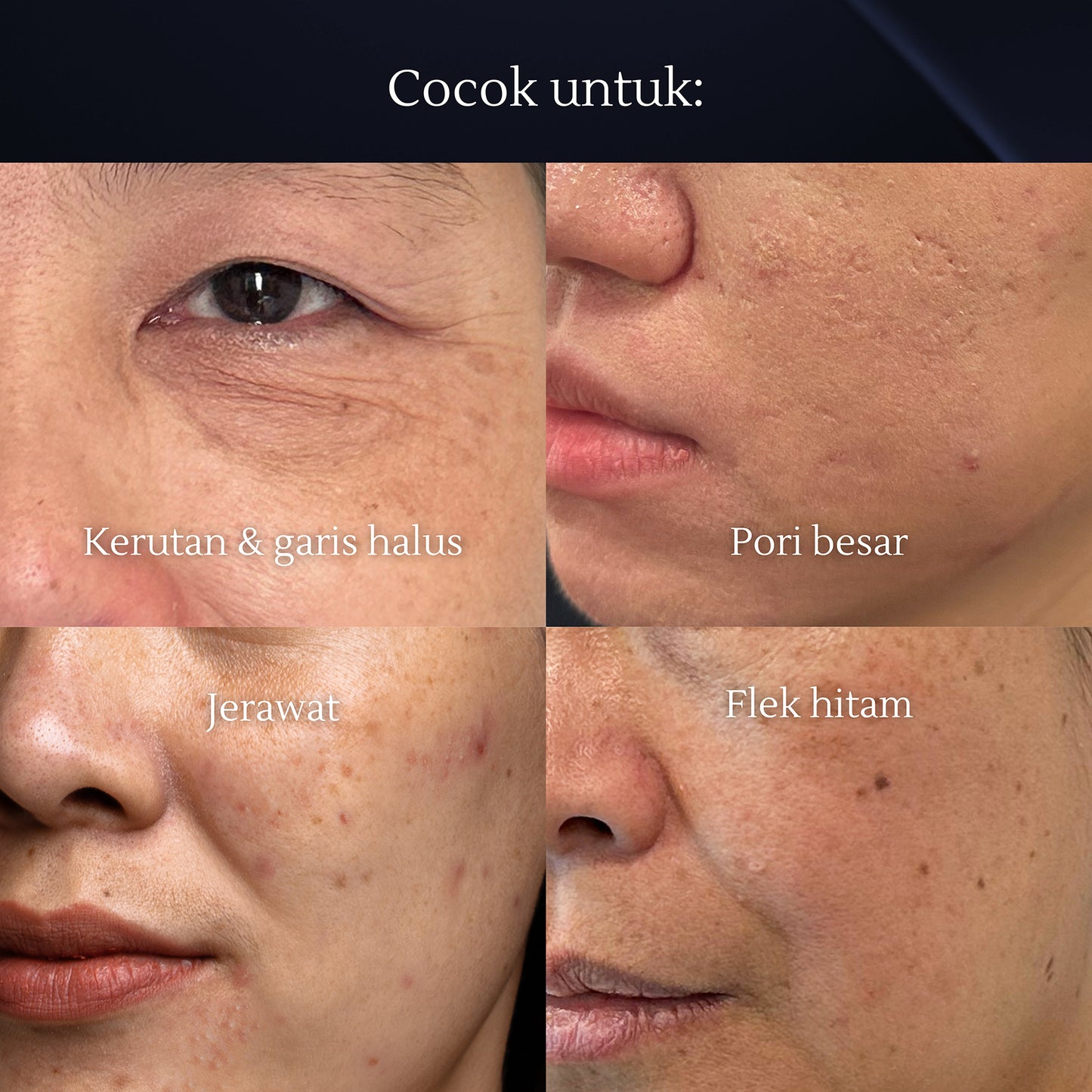 Retinol Lifting Cream 50ml | Kulit Kusam | Anti Aging | Kulit Kendur | Melembabkan Wajah | Ultra Firming Solution | Retinol Cream