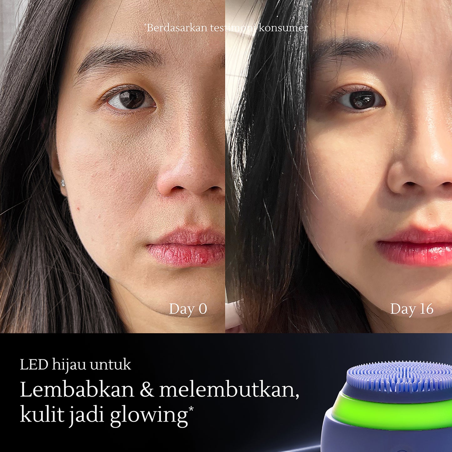 Facial Sonic Cleansing Device | Pembersih Wajah | Pembersih Wajah Elektrik | Jerawat | Kulit Kusam | Kulit Kendur | Komedo | Bekas Jerawat | Bruntusan | Deep Cleansing | Pembersih Wajah Silikon Tahan Air | Alat Pembersih Wajah
