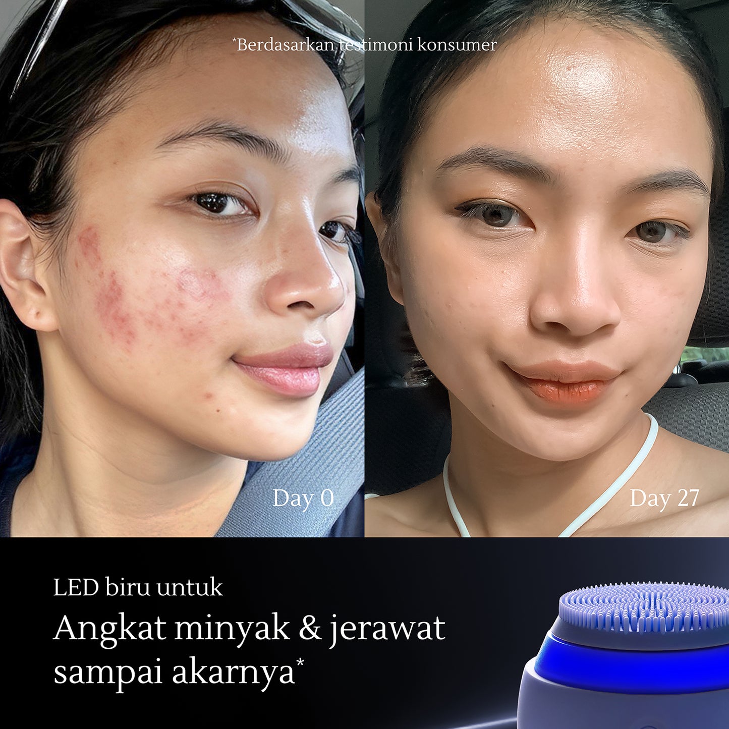 Facial Sonic Cleansing Device | Pembersih Wajah | Pembersih Wajah Elektrik | Jerawat | Kulit Kusam | Kulit Kendur | Komedo | Bekas Jerawat | Bruntusan | Deep Cleansing | Pembersih Wajah Silikon Tahan Air | Alat Pembersih Wajah