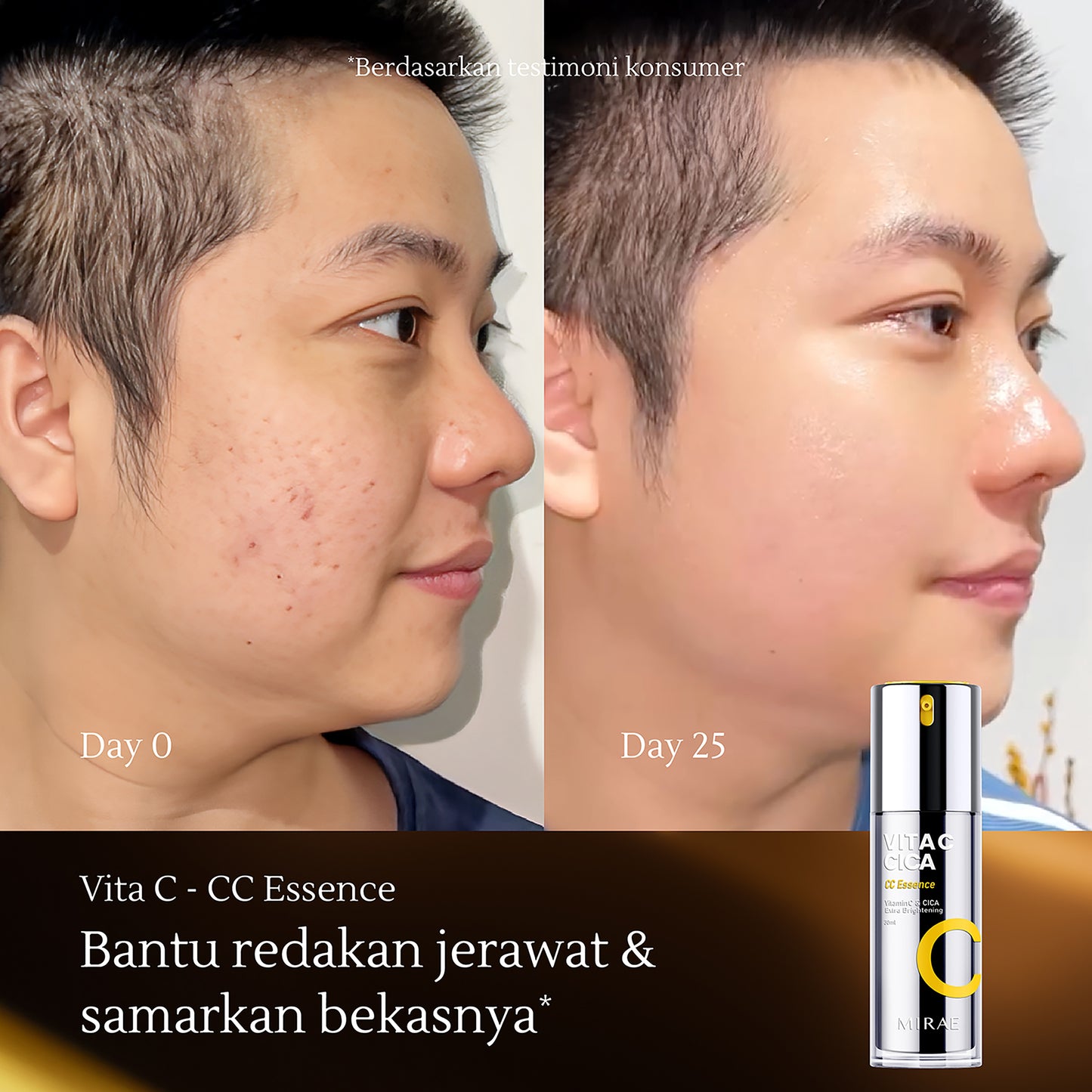 Vitamin C CICA Extra Brightening Essence 30ml | Kulit Kusam | Jerawat | Noda Hitam | Bekas Jerawat | Flek Hitam | Bruntusan | Kulit Kemerahan | Mencerahkan Kulit | Glowing