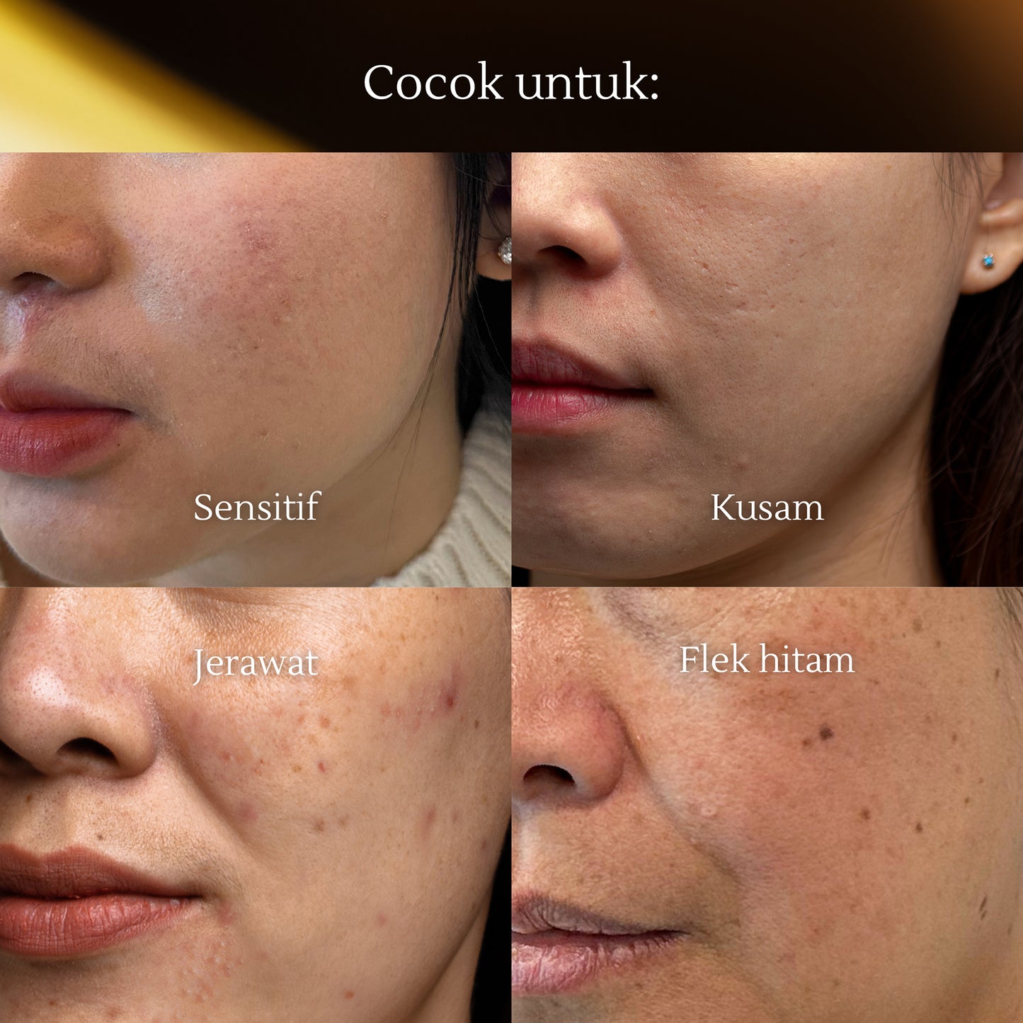 Vitamin C CICA Extra Brightening Essence 30ml | Kulit Kusam | Jerawat | Noda Hitam | Bekas Jerawat | Flek Hitam | Bruntusan | Kulit Kemerahan | Mencerahkan Kulit | Glowing