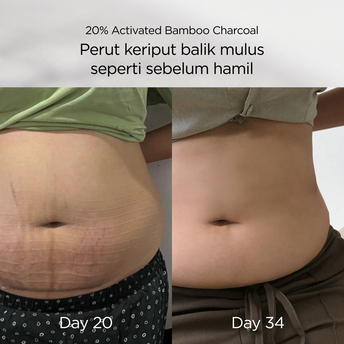 Mamaway Korset Pasca Melahirkan Pelangsing / FAST SLIM Antibakteri & Aman untuk Caesar Nano Bamboo