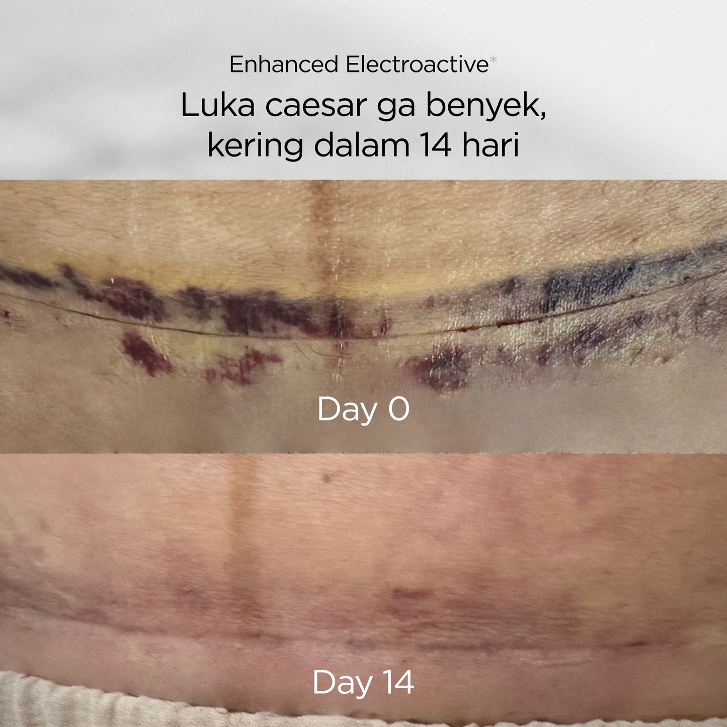 Mamaway Korset Pasca Melahirkan Pelangsing / FAST SLIM Antibakteri & Aman untuk Caesar Nano Bamboo