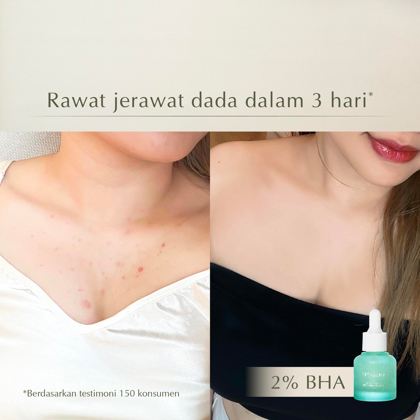 2% Salicylic Acne Solution Serum | Anti jerawat | Meredakan Jerawat | Salicylic Acid | Niacinamide | Serum Jerawat | Gentle Exfoliator | Mengurangi kemerahan | Membersihkan Pori | Mencerahkan kulit kusam |  Menenangkan kulit sensitif