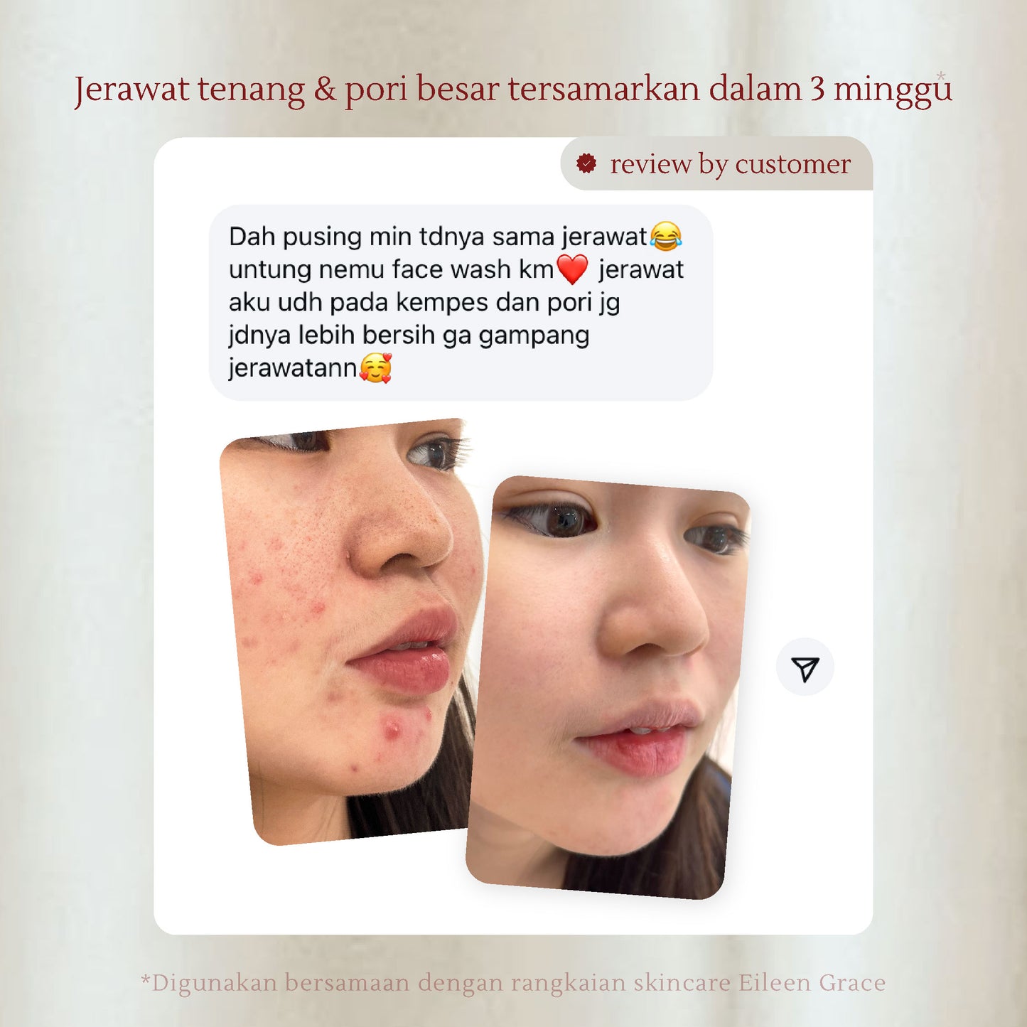 Deep-Cleansing Black Jelly Mask 300 ml + Salicylic Acid Anti-Acne Foaming Cleanser 150 ml