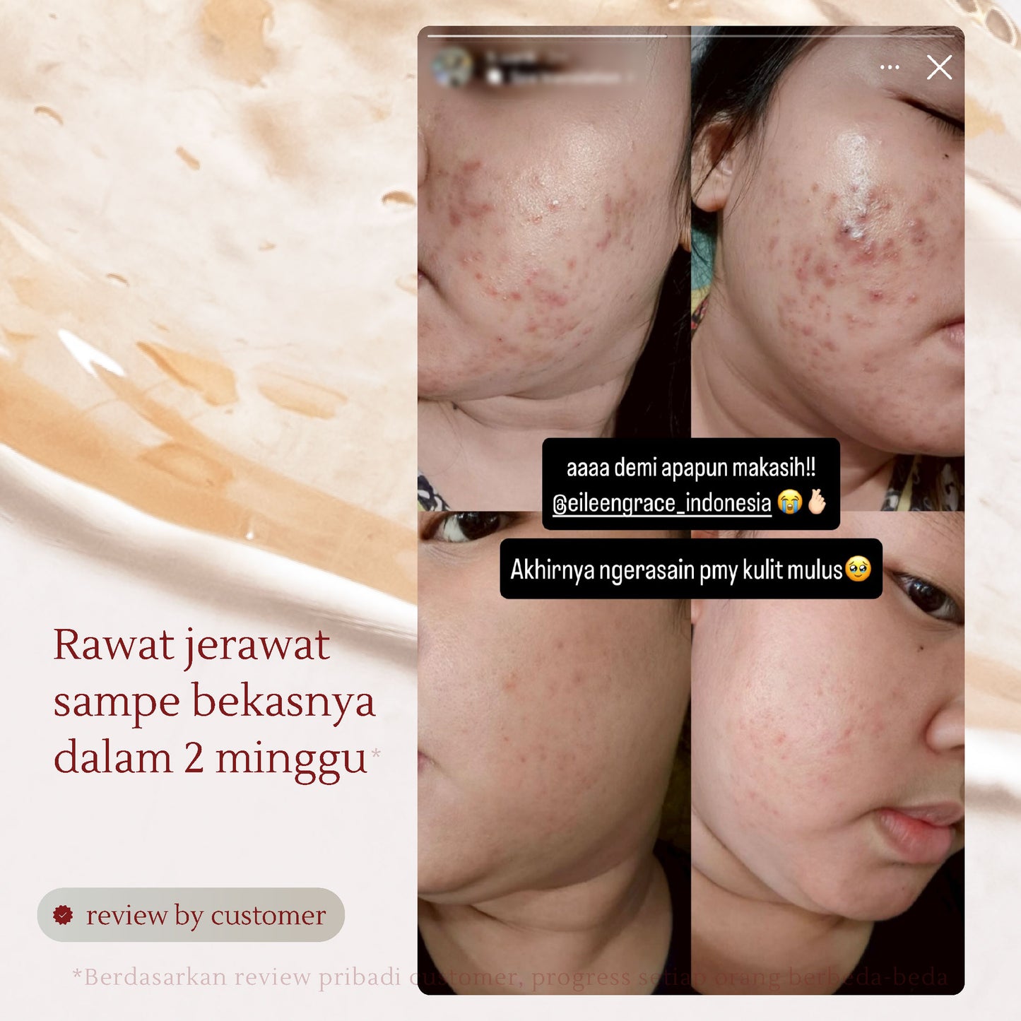 Moisturize Rose Jelly Mask + Deep-Cleansing Black Jelly Mask 300ml