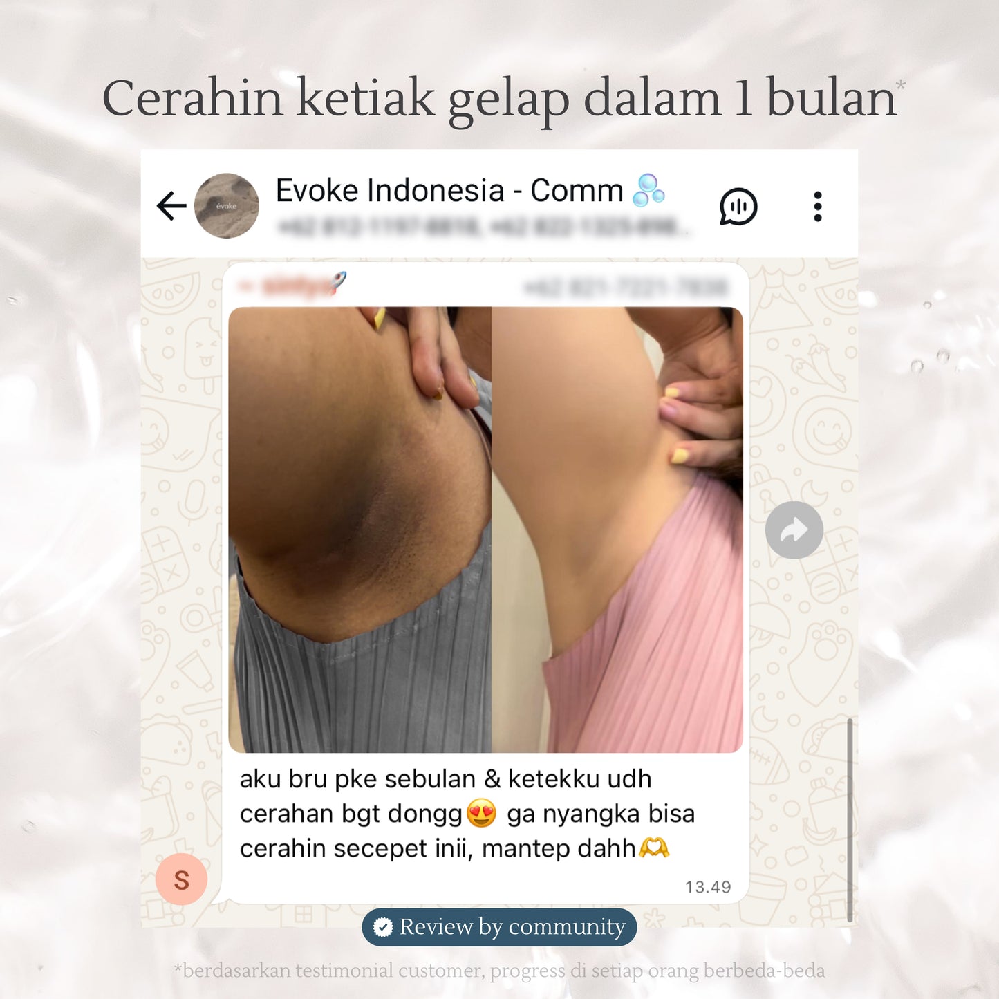 Afternoon Teahouse Bodywash | Sabun Mandi/Lipatan Gelap/Kulit Kering/Gatal/Luka Basah (300ml)