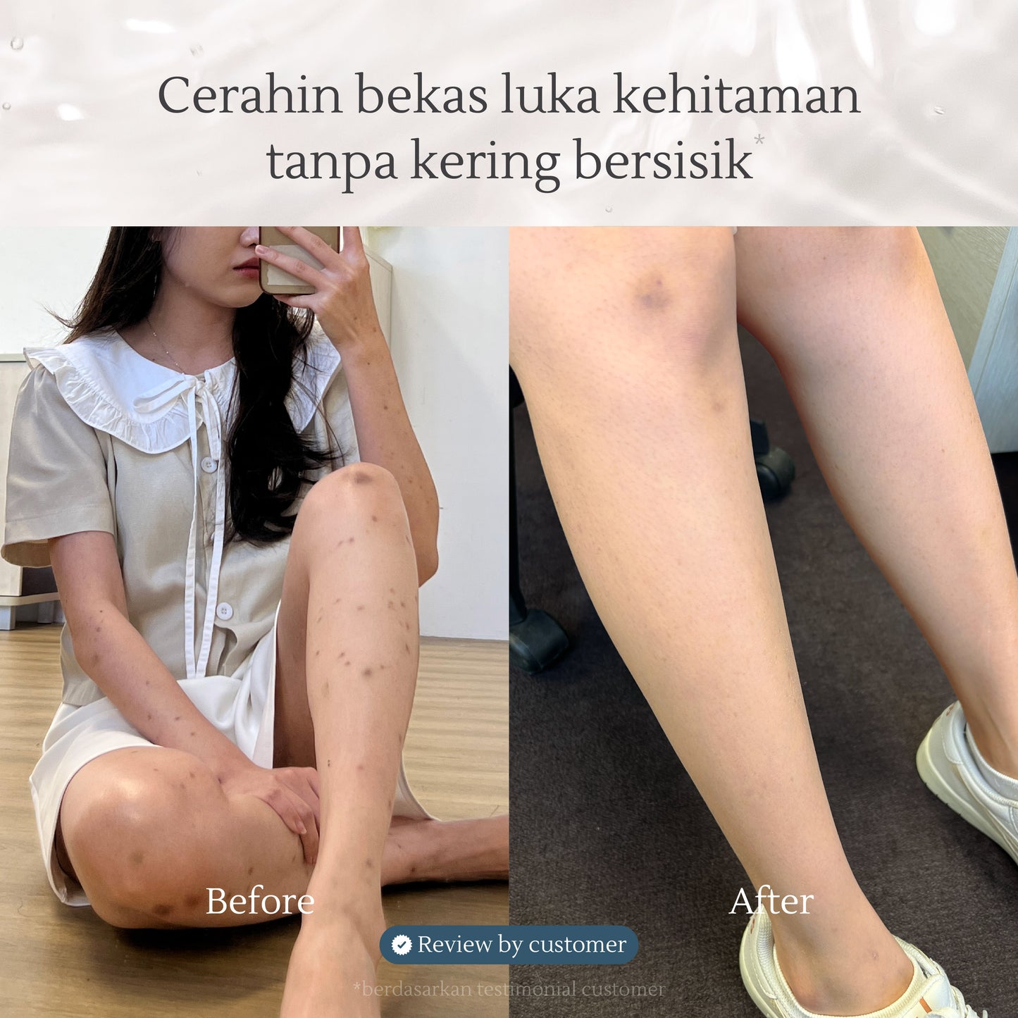 Coastal Journey Bodywash | Sabun Mandi/Sabun Koreng/Luka Kering/Gatal/Kulit Sensitif (300ml)