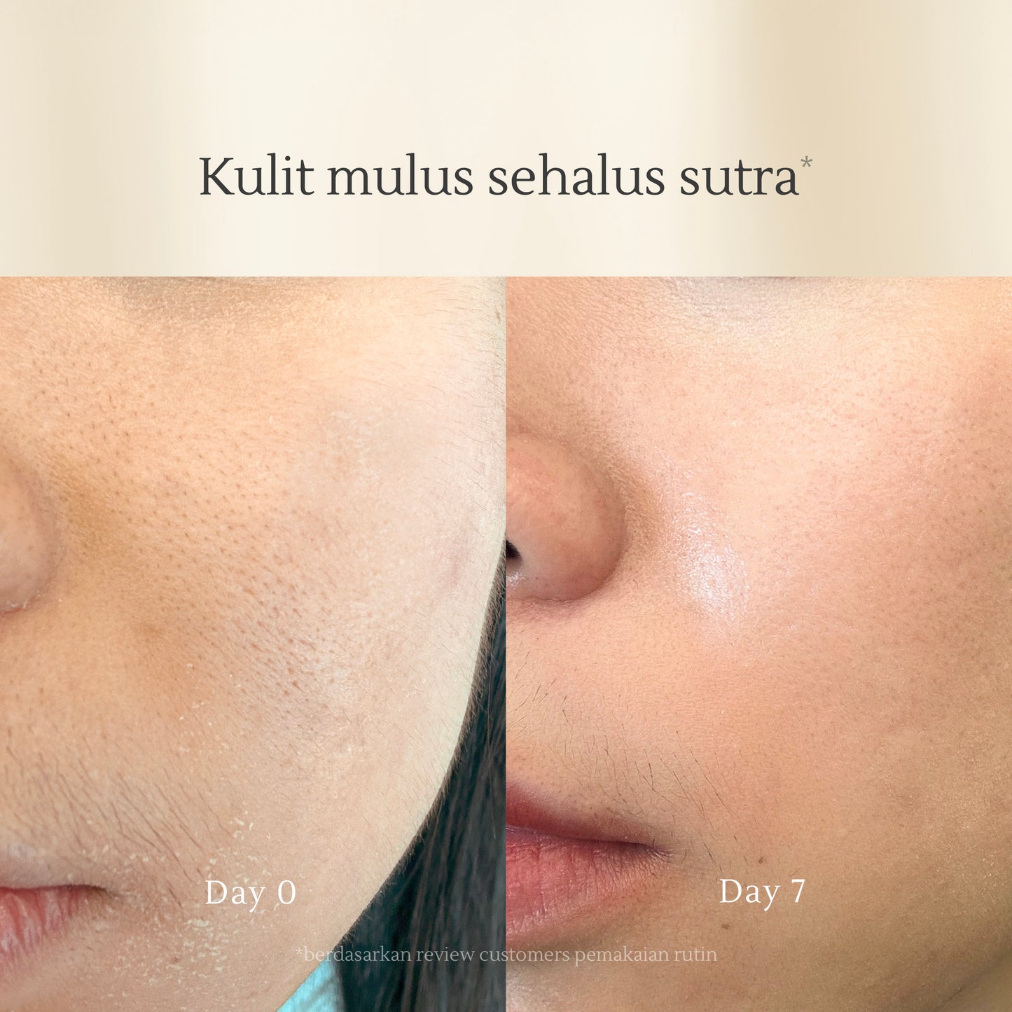 All Use Toner 200ml | Kulit Kering & Sensitif | Kusam | Skin Texture | Hydrating | Moisturizing | Perkuat Skin Barrier | Alcohol Free | Fragrance Free