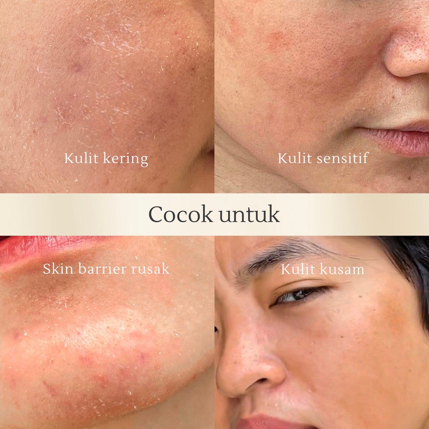 All Use Toner 200ml | Kulit Kering & Sensitif | Kusam | Skin Texture | Hydrating | Moisturizing | Perkuat Skin Barrier | Alcohol Free | Fragrance Free