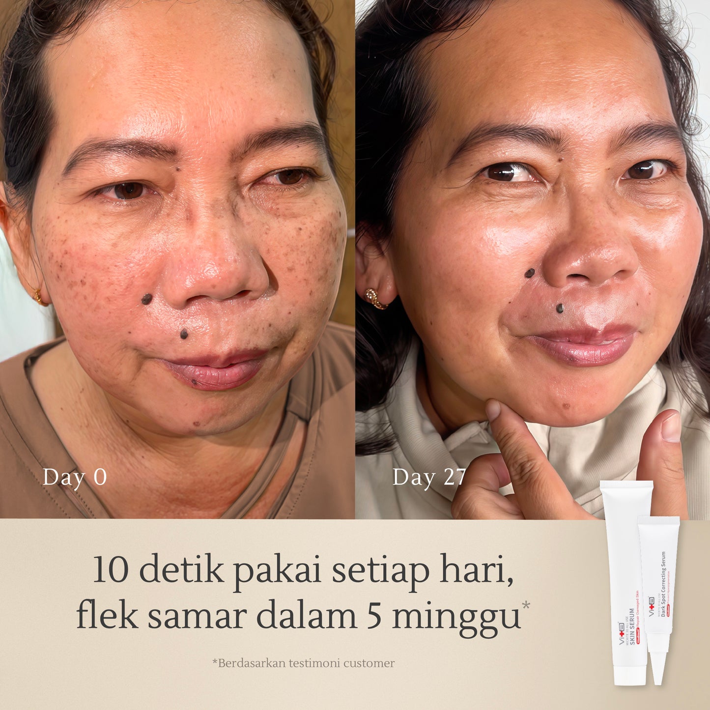 Glowing Set Bundle | Samarkan noda hitam, kerutan, Kulit tampak sehat dan cerah merata