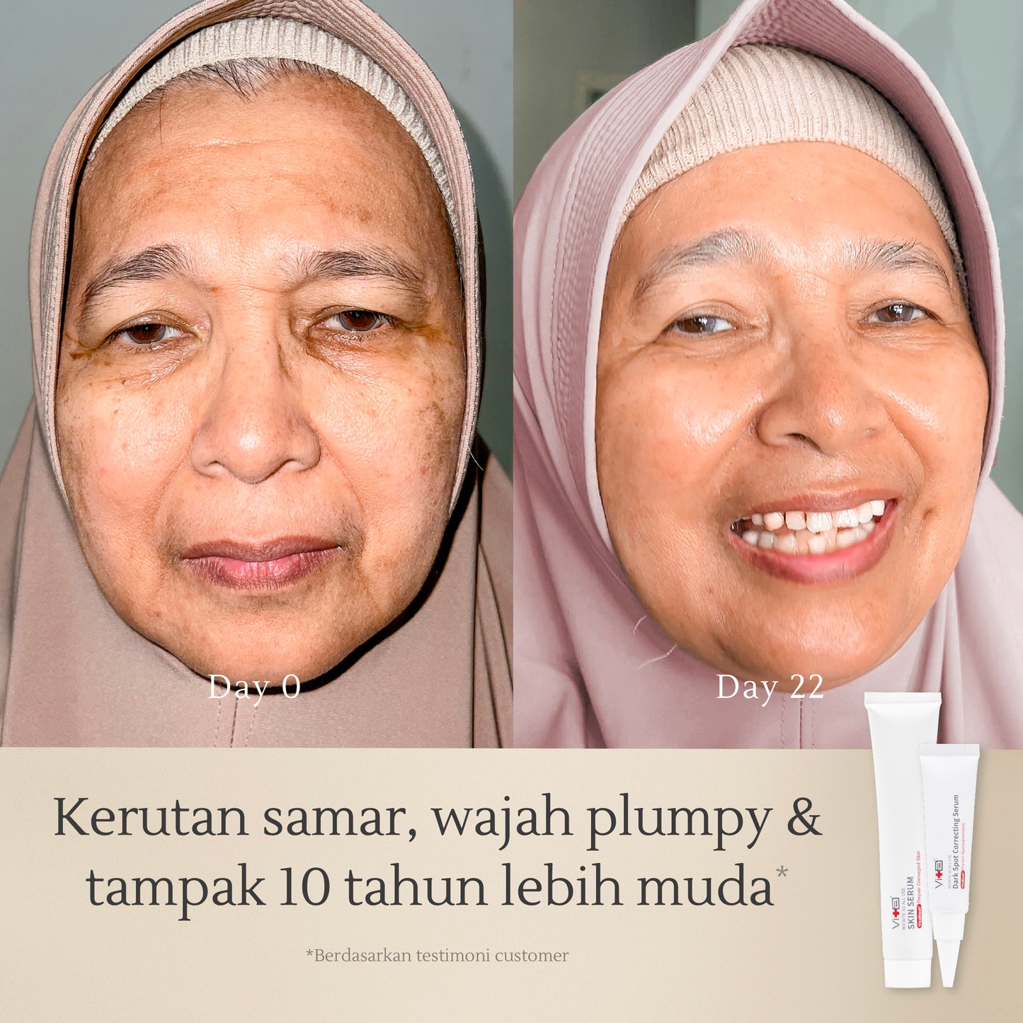 Glowing Set Bundle | Samarkan noda hitam, kerutan, Kulit tampak sehat dan cerah merata