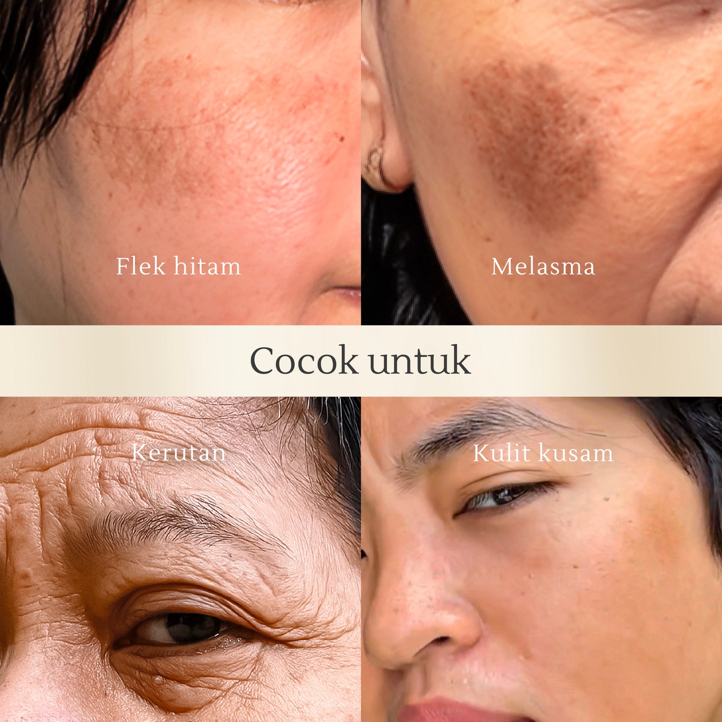 Glowing Set Bundle | Samarkan noda hitam, kerutan, Kulit tampak sehat dan cerah merata