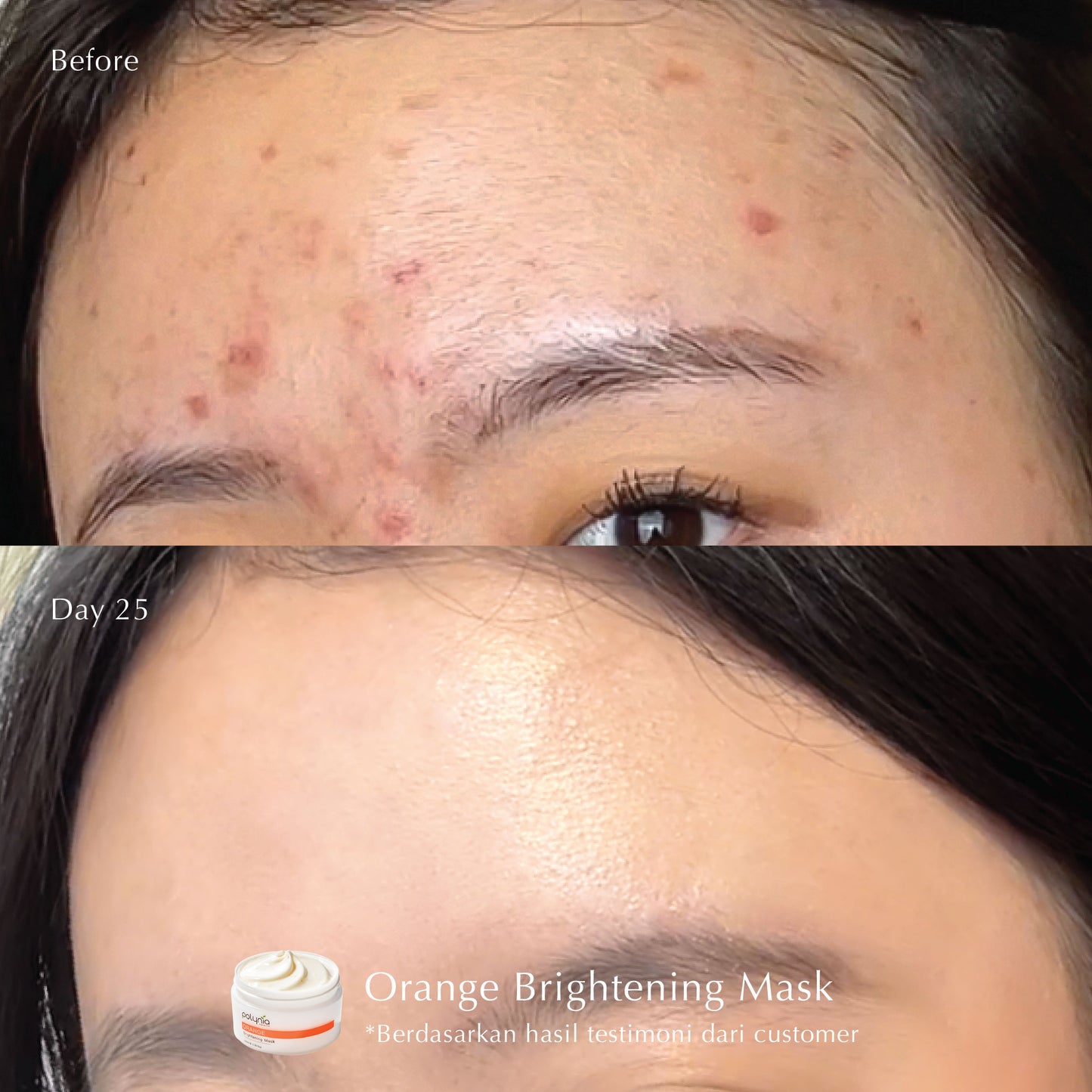 Orange Brightening + Pomegranate Revitalizing | Vitamin C | Samarkan Bekas Jerawat | Samarkan Kerutan & Garis Halus | Samarkan Flek Hitam | Masker wajah | BPOM