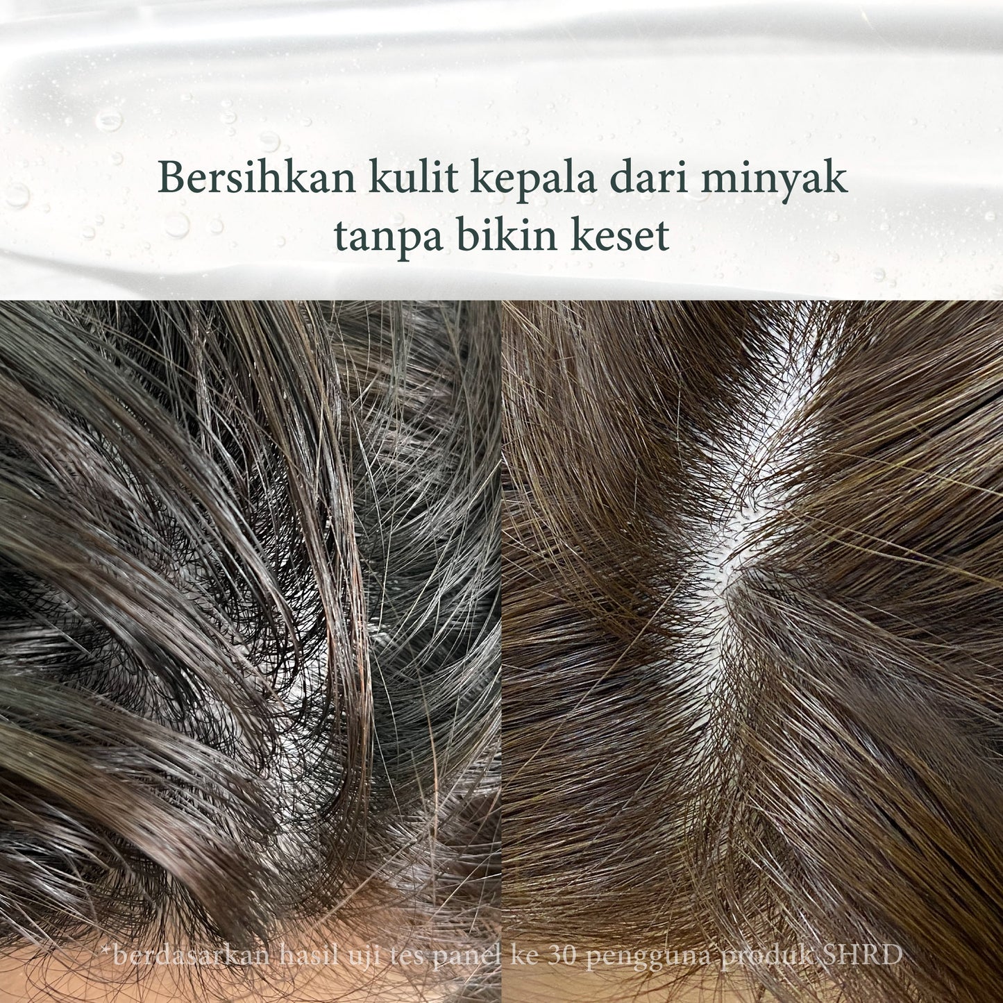 SHRD Bundle | Paket Atasi Rambut Rontok dan Patah | Red Ginseng Shampoo | Hair Essence | Protein Cream | Sisir Anti Kusut | Tipis | Rontok | Kusut | Patah