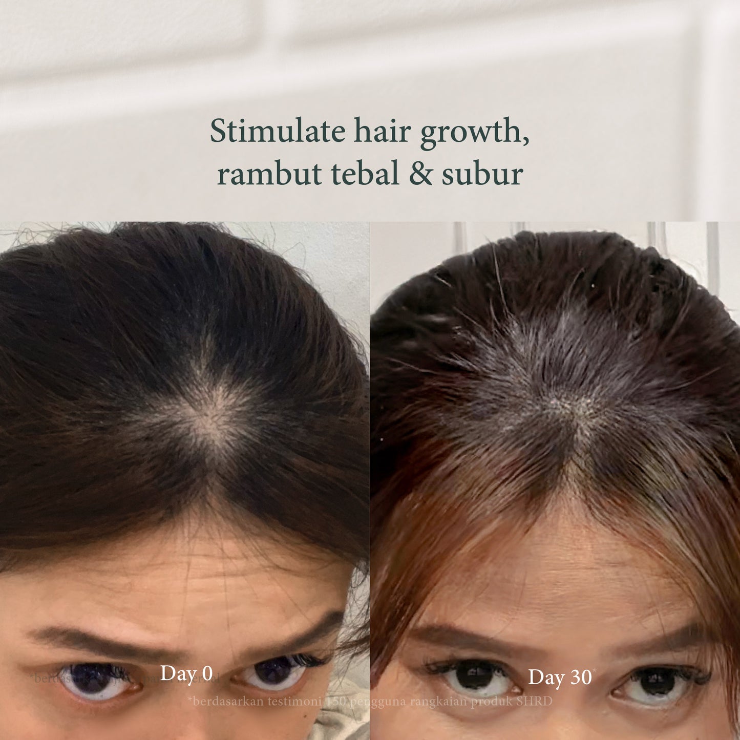 Scalp Comb | Stimulasi Pertumbuhan Rambut & Scalp Relaxation Massager for Hair Growth