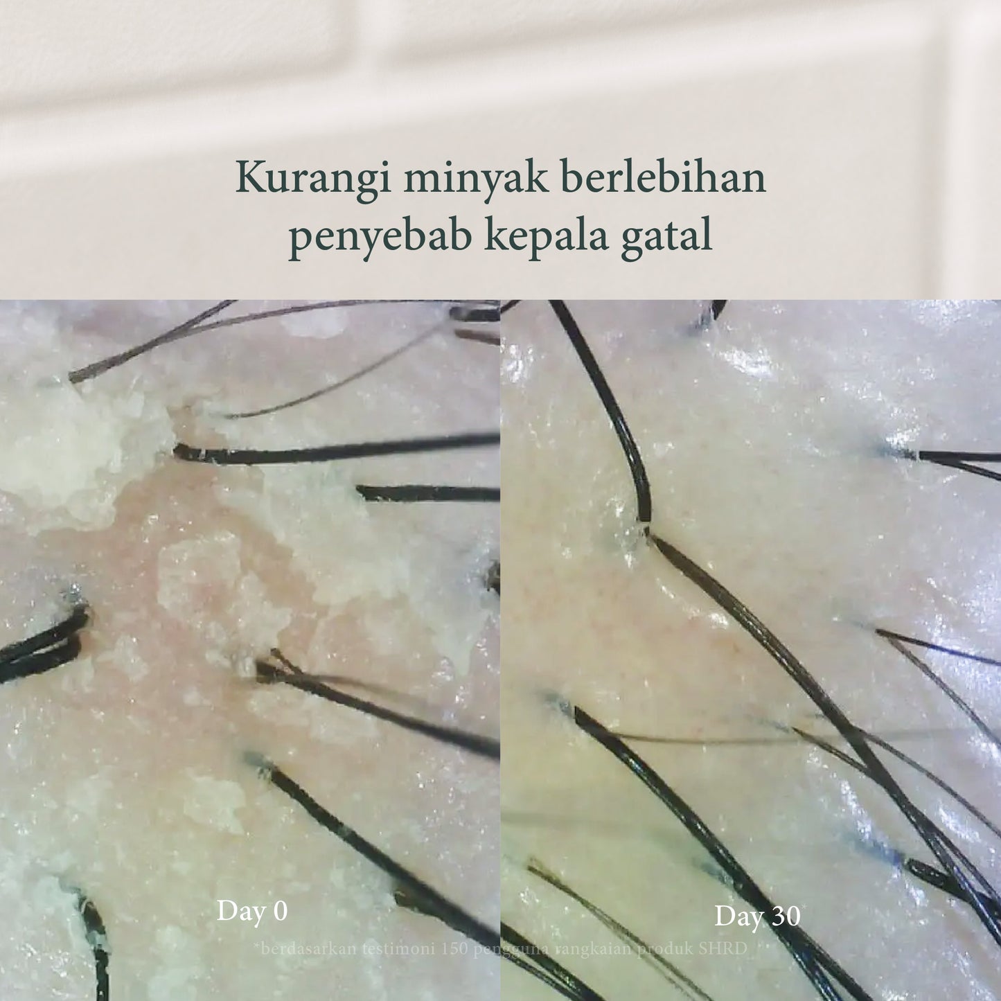 Scalp Comb | Stimulasi Pertumbuhan Rambut & Scalp Relaxation Massager for Hair Growth