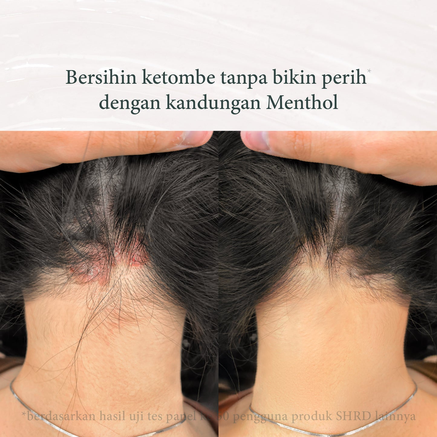 Thyme Shampoo | Shampoo untuk Ketombe  | Perawatan Rambut | Haircare