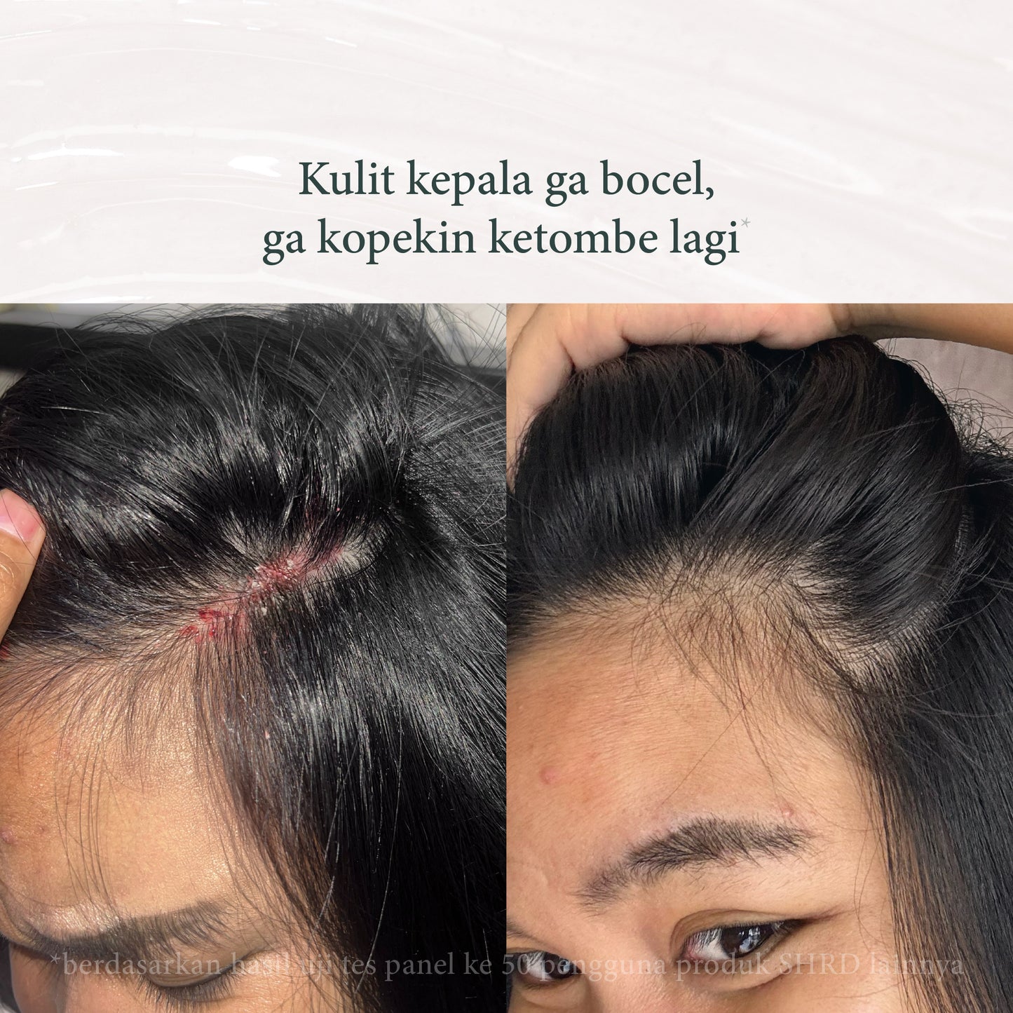 Thyme Shampoo | Shampoo untuk Ketombe  | Perawatan Rambut | Haircare