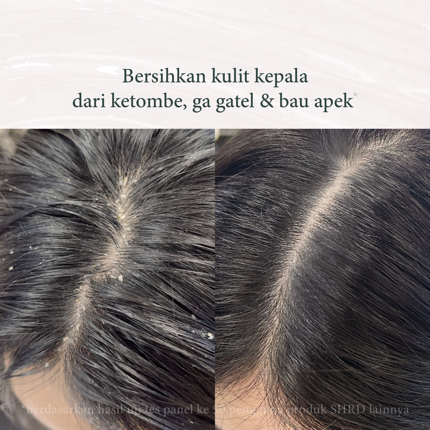 Thyme Shampoo | Shampoo untuk Ketombe  | Perawatan Rambut | Haircare