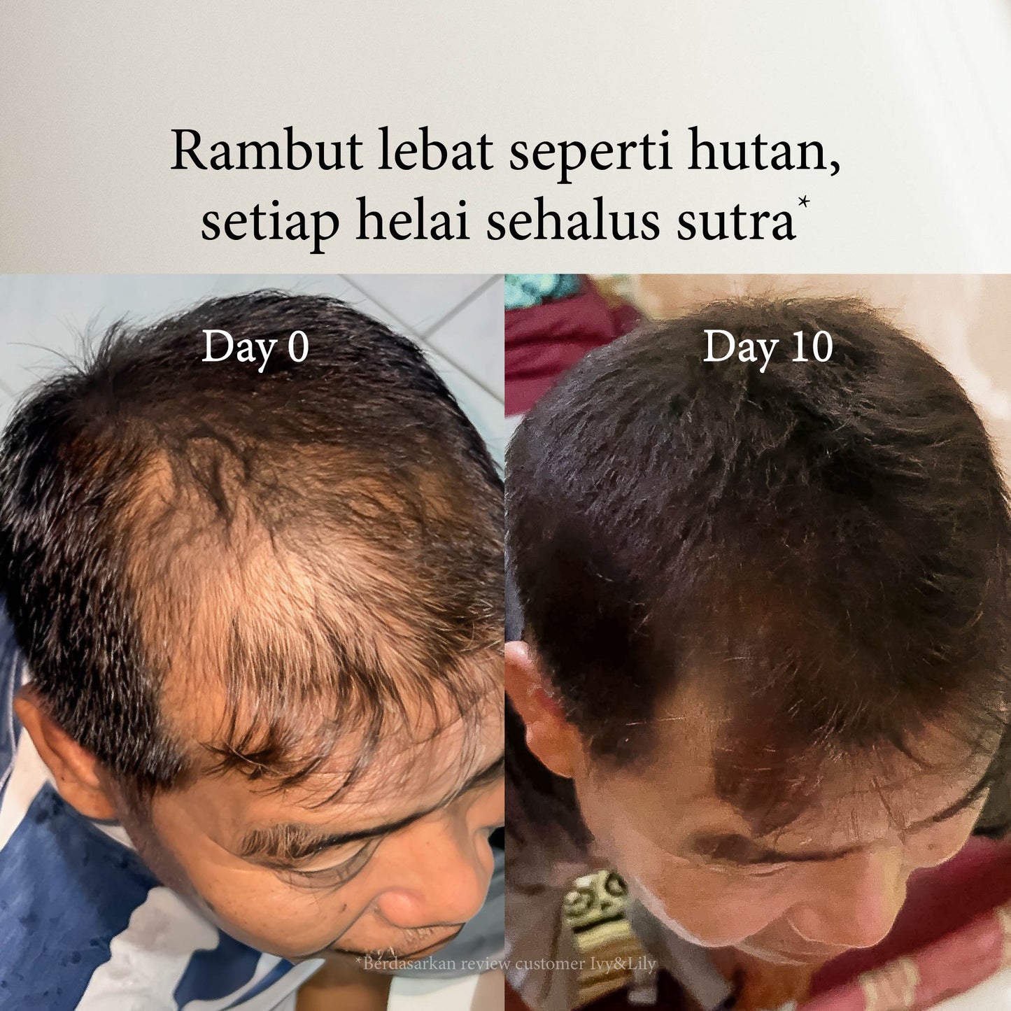 Flower Alley SLS-free Hairfall Shampoo | Perawatan Rambut Rontok | Penumbuh Rambut | Cegah Rontok